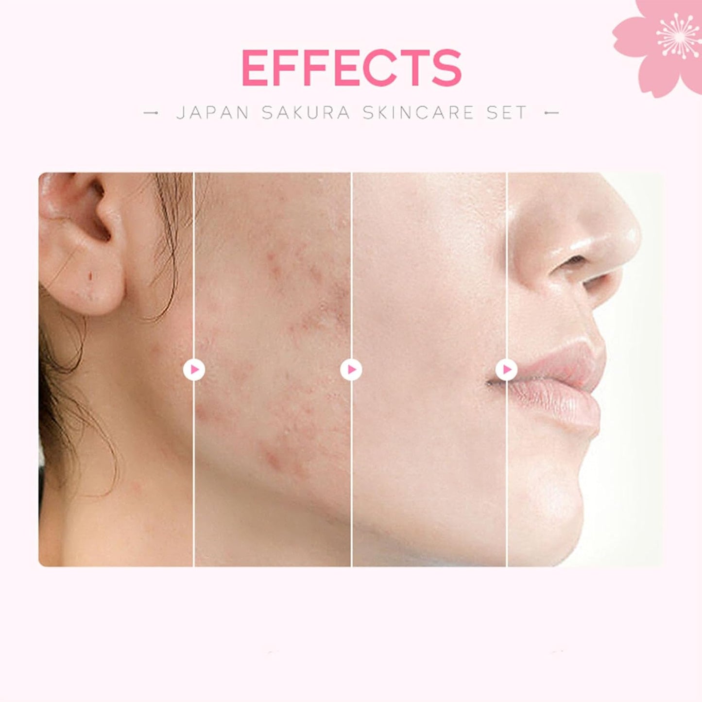 Skin Care Set, Cherry Facial kit for women, Skincare Kit Gifts For Teenage Girls, Skin Care Kit, Skincare Sets & Kits with facial wash, Toner, Serum, Eye Cream, Face Cream Birthday Beauty Care 5pcs