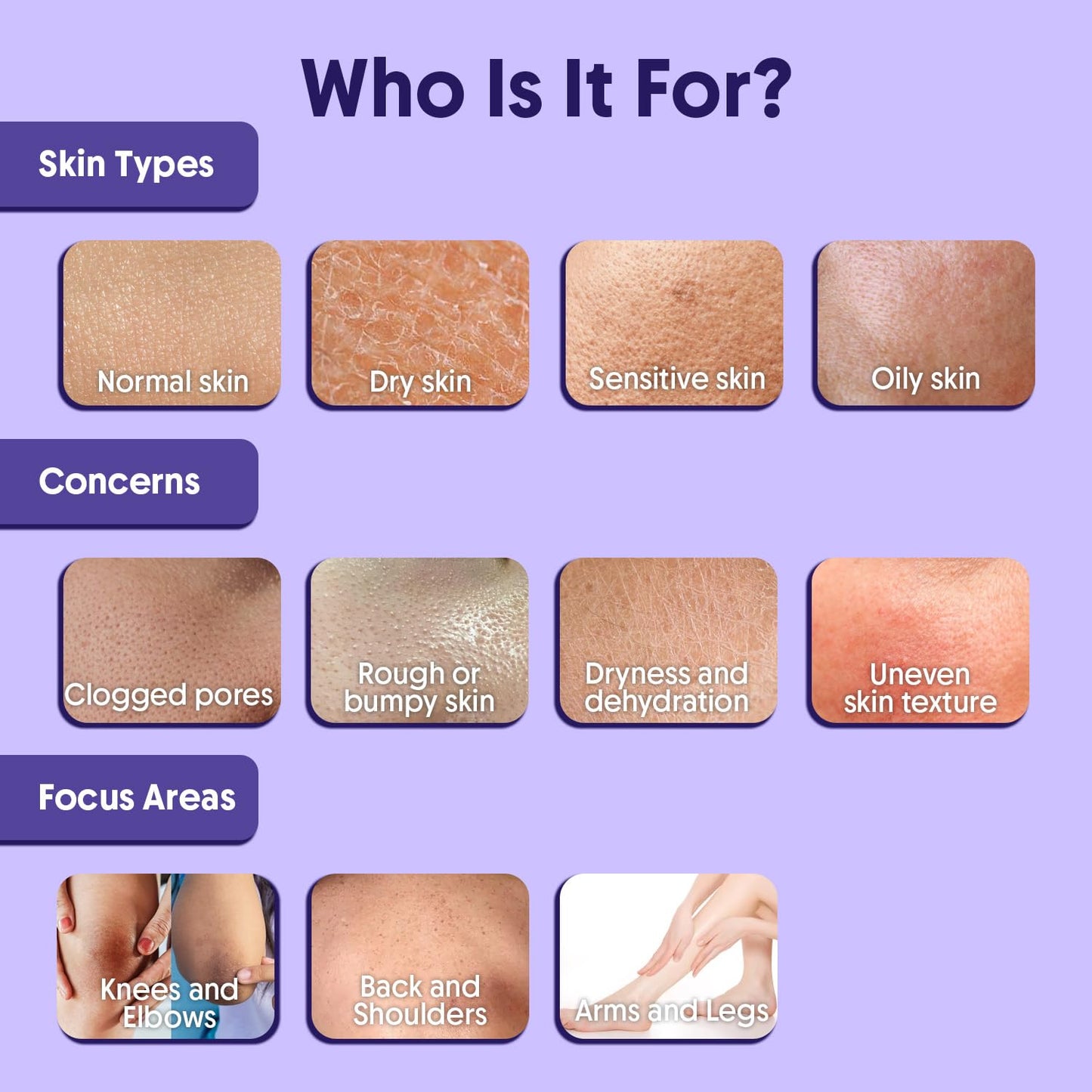 Aravi Organic 10% AHA + 1% BHA Exfoliating Body Lotion - Glycolic & Lactic Acid Body Lotion with Niacinamide - Smooths Rough & Bumpy Skin with Anti-Aging - 6.76 Fl Oz / 200ml