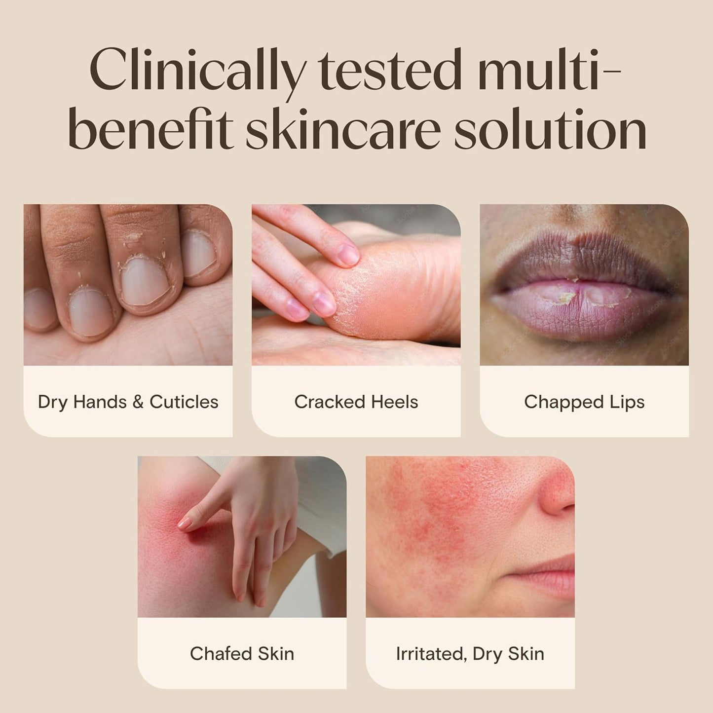 Aveeno Skin Relief Healing Ointment, 72-Hour Skin Protectant with Triple Oat & Shea Butter for Extra Dry, Cracked & Sensitive Skin, Fragrance-Free & Multi-Use for Lips, 7.2 oz