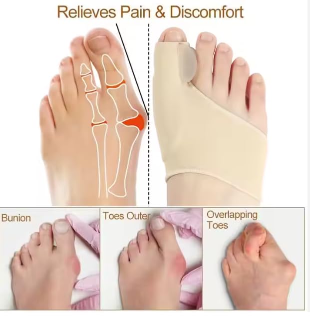 2-in-1 Foot Care Kit – Toe Correctors for Women and Men & Metatarsal Pads – Ball of Foot Cushions for Heels, Toe Separators for Alignment, Blister Prevention, Forefoot Pain Relief Bundle