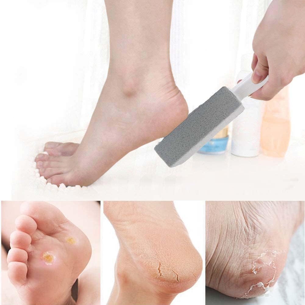 Pumice Stone for Toilet Bowl Cleaning with Handle Household Cleaning 6 Pack