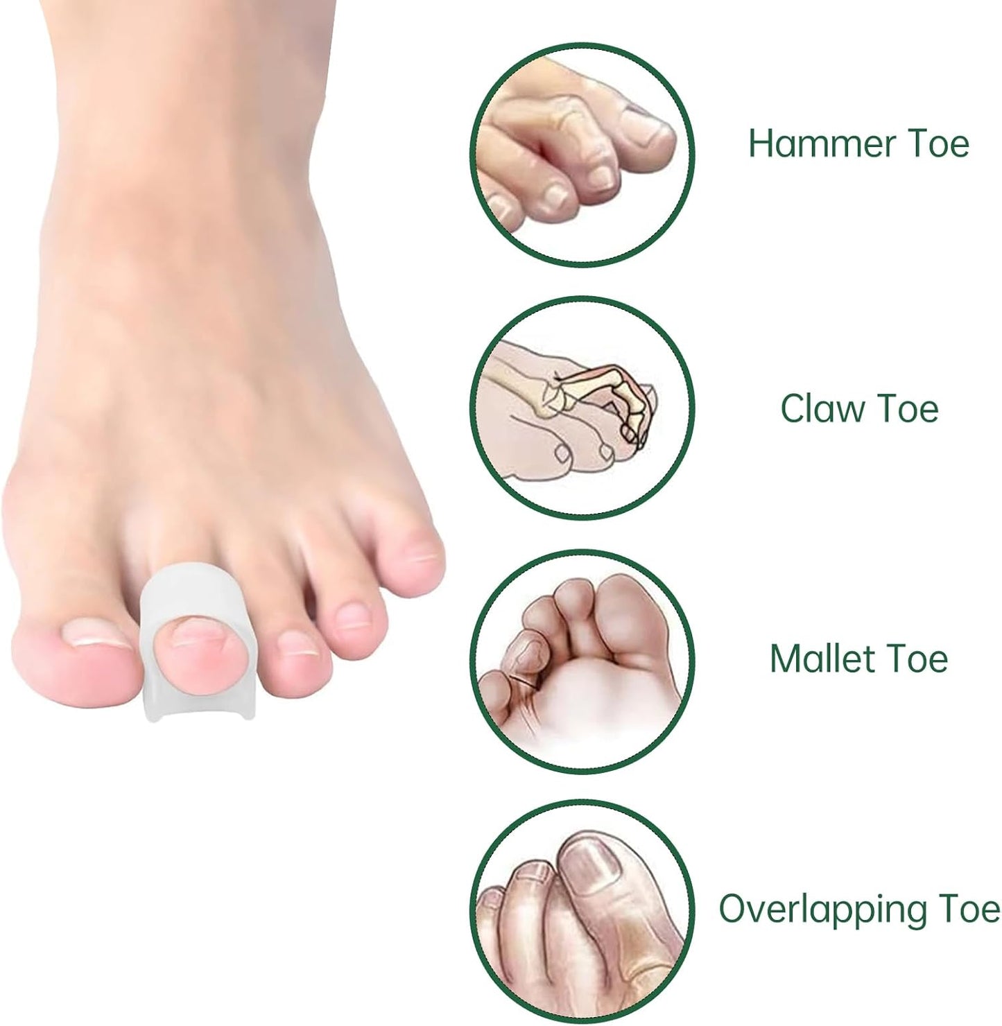 Gel Hammer Toe Corrector - Hammer Toe Straightener for Women and Men, Toe Protectors & Hammer Toe Cushion, Soft Silicone Hammer Toe Straightener Corrector, Pack of 8