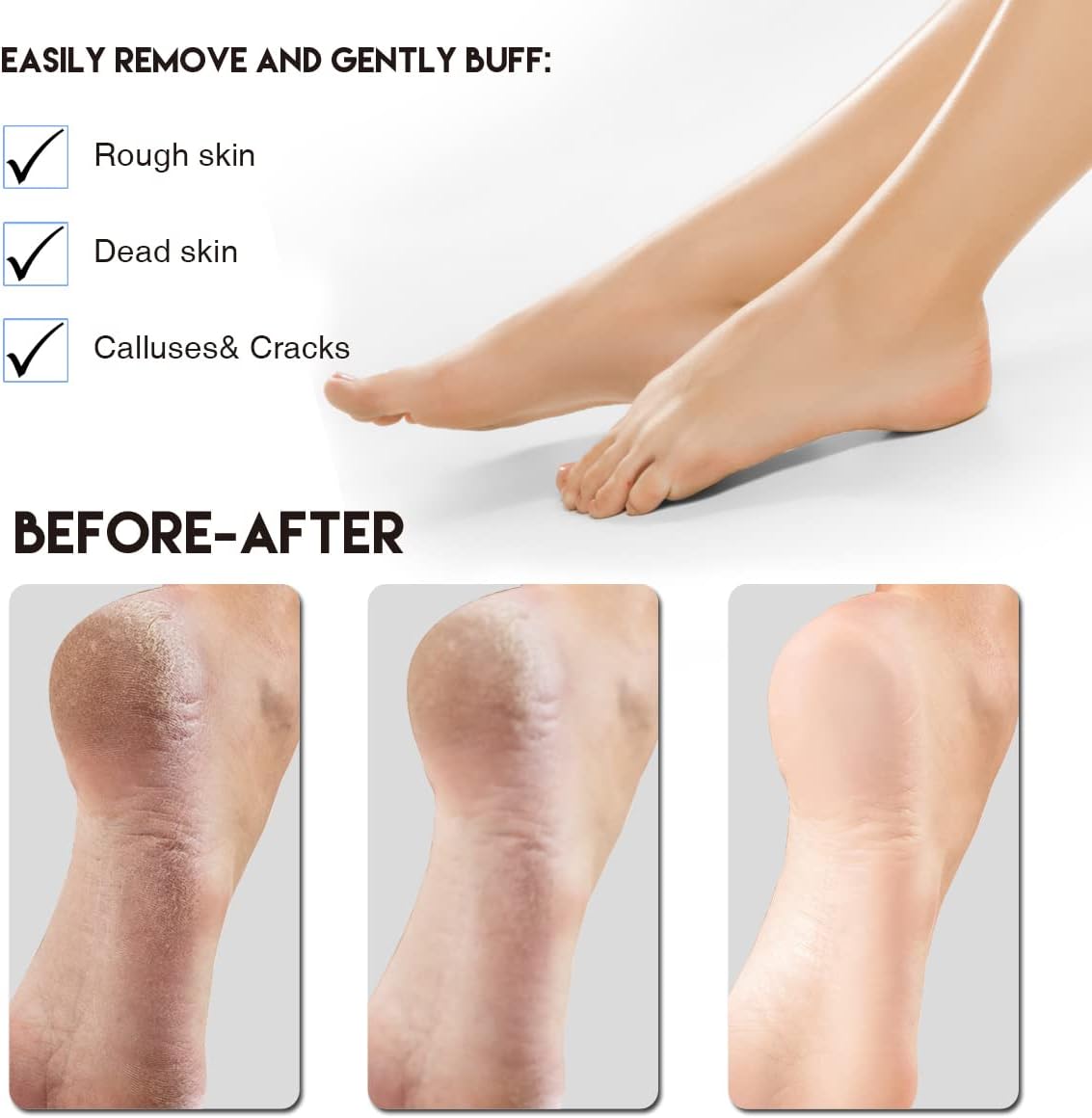 AM 8:00Pumice Stone Foot File, 2 Pack Callus Remover (coarse/fine) for Feet with Wooden Handle, Pedicure Foot Scrubber to Remove Dead Skin, Dry, Rough, Corns Skin Scraper