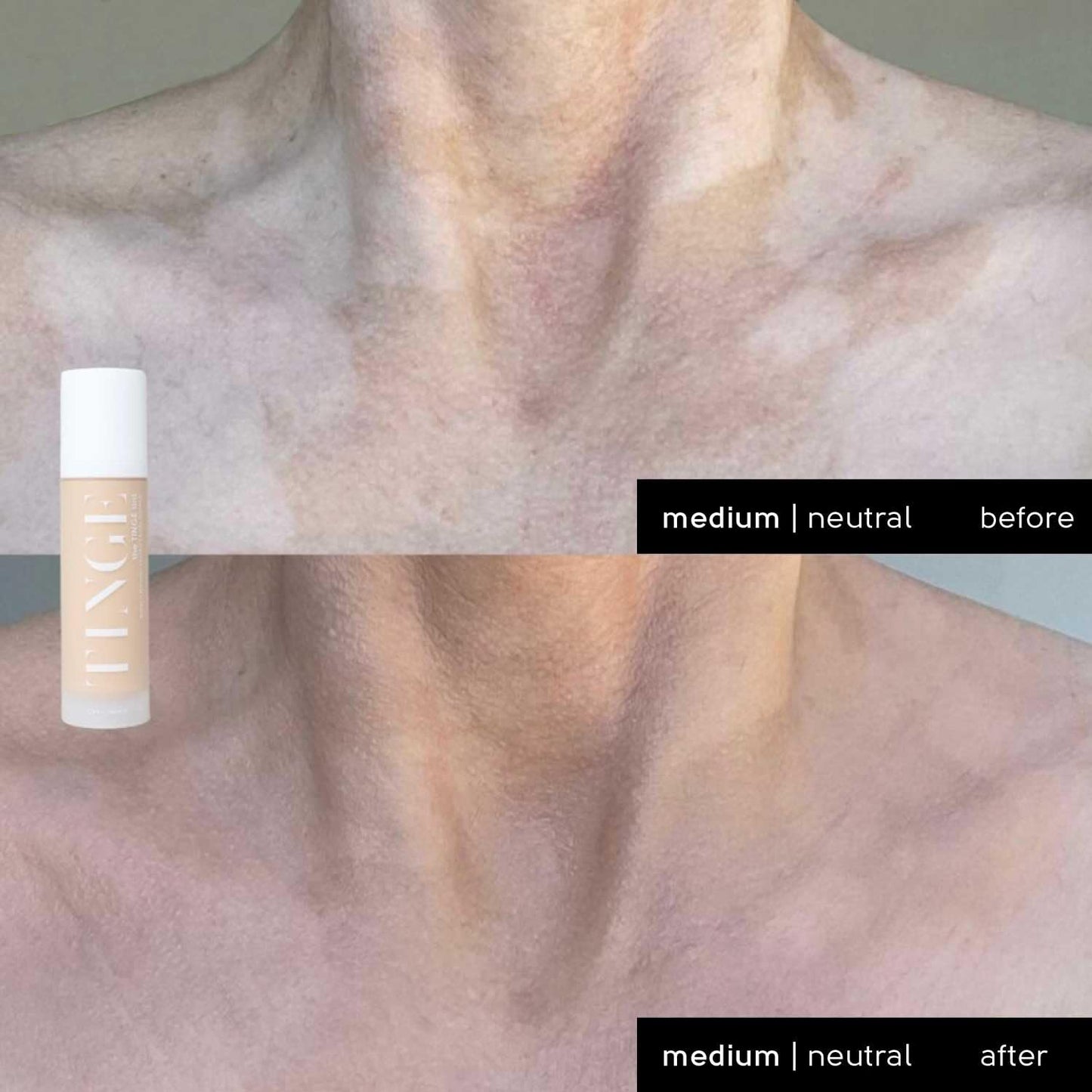 Tinge Tint Body Makeup, Lasts Up to 48 Hours, Medium Coverage Cream With Amino Acids, Hyaluronic Acid & Lysine, Semi Matte Finish, Water & Transfer Resistant, 3.38 Fl Oz - Medium Cool