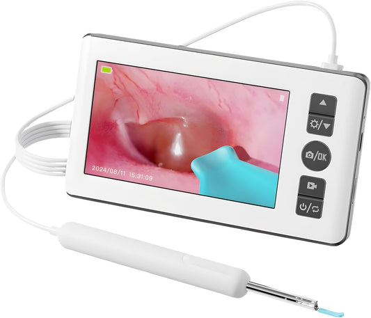 Ear Wax Removal Kit with Camera | Ear Cleaner with 4.3" IPS Display, 1080P HD, 2500mAh Battery, Silicone Tips | Standalone Tool, No Phone Required