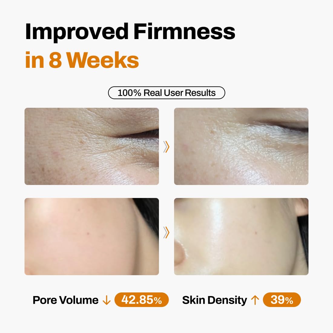 JEU'DEMEURE DermiShuttle Lifting Kit - Anti Aging Serum, Face Serum for Firming, Anti Wrinkle, Skin Elasticity, Hydrating with Collagen, Peptides, Korean Skincare (8 Weeks)