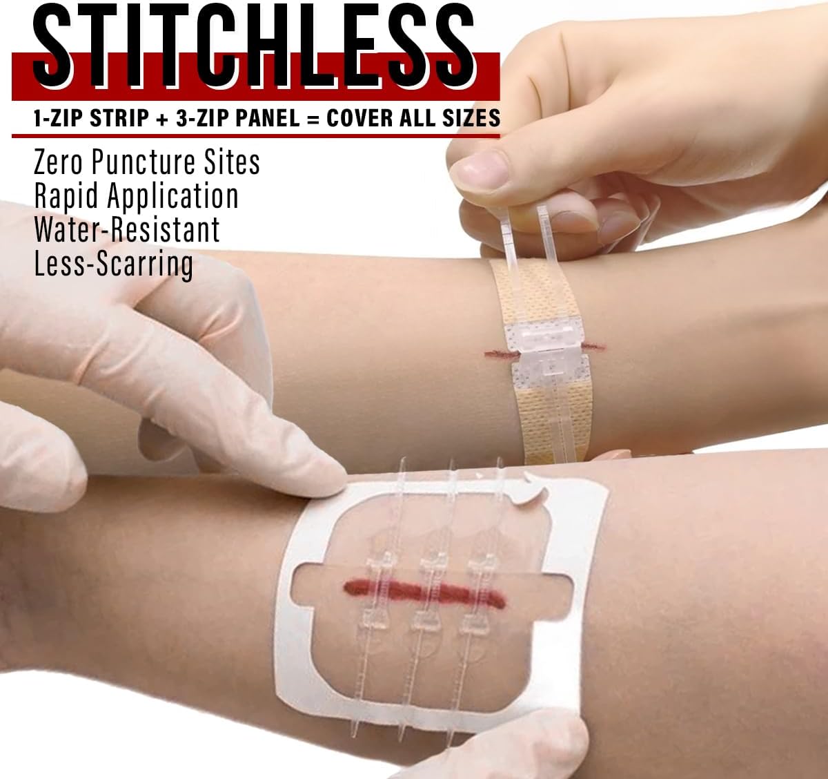 EVERLIT Wound Closure Kit | Surgical Zip-Stitch Devices for Cut & Laceration | Sterile, Suture-Free, Stitch-Less Adhesive Butterfly Bandages for Emergency First Aid Wound Care (6 Zip Complete Kit)