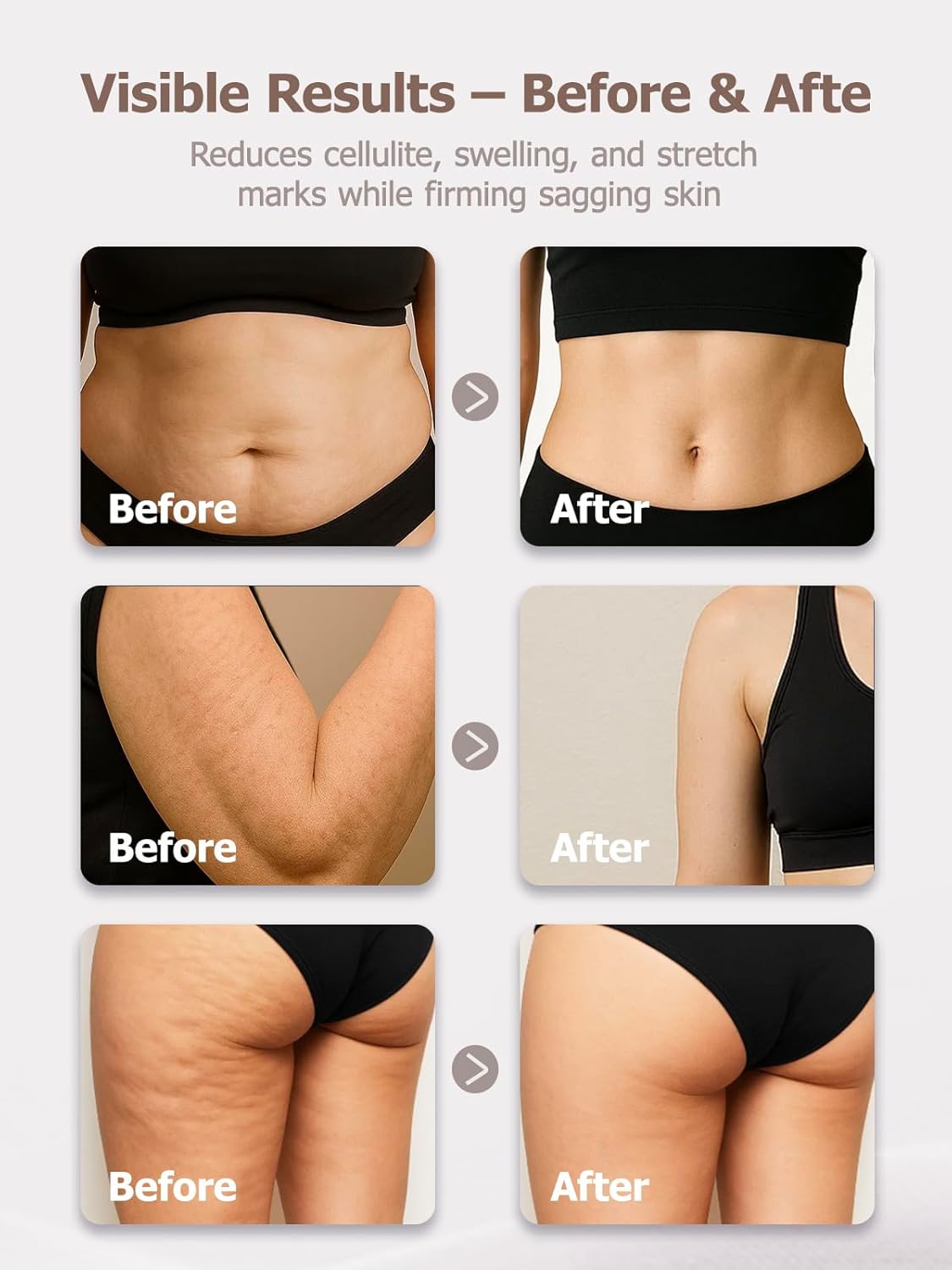 DiDEER Lymphatic Drainage Massager & Anti Cellulite Massage Tool, for Legs, Arms & Belly, Body,Helps Reduce Stretch Marks & Cellulite,with Microcurrent, Light Heat & Vibration