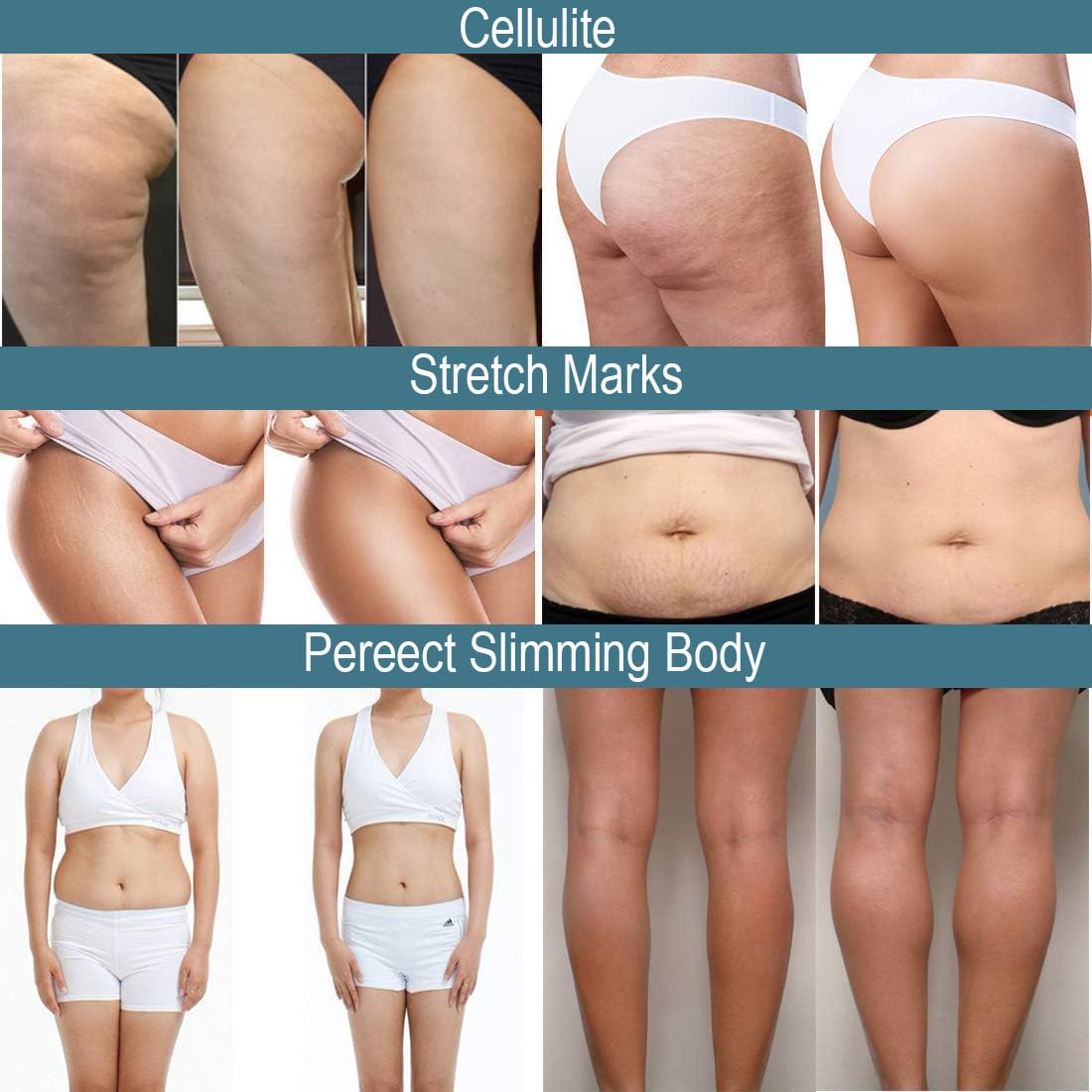 CRYOACTIVE SLIM GEL, Body Contour Gel for Firmer Skin, Anti-cellulite for Men & Women, Tightening Gel for Tummy, HIPS and Buttocks