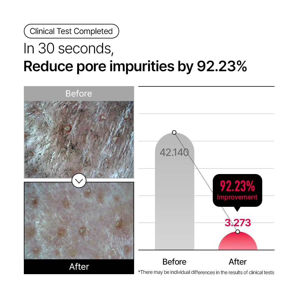 Parnell Aha Omija Ceramic Cleansing Oil 200ml / 6.76 fl.oz | blackhead melting, korean facial cleanser, korean skincare