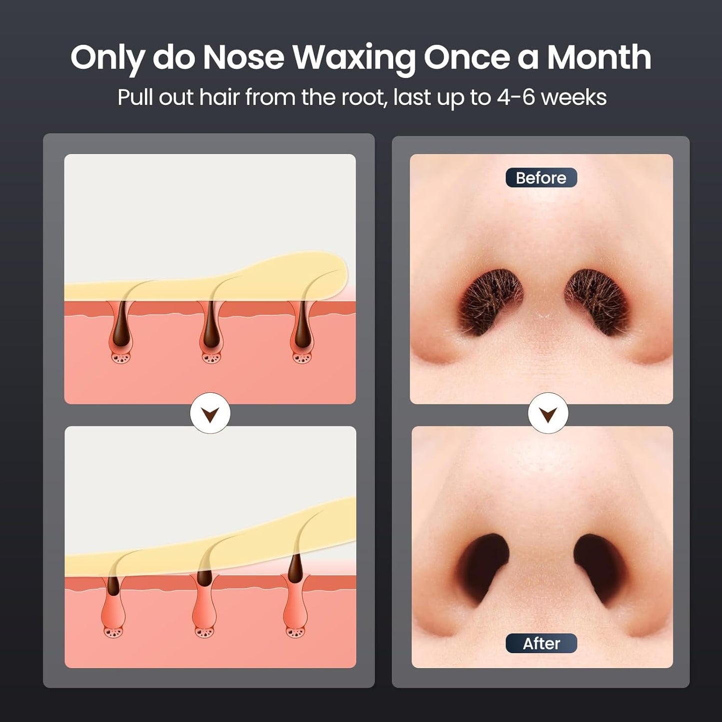 Nose Wax Kit Men, Nose Hair Waxing Kit with 158°F Smart Temp Control, 40 Sticks, 100g Wax, Painless Nose Hair Removal with USB-C Fast Heating, Upgraded Capacity, Multi-Accessories