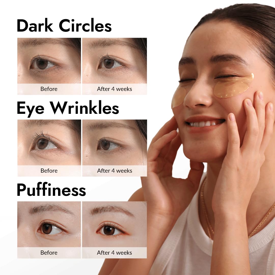 MIZON 24K Gold and Snail Mucin Hydrogel Under Eye Patches for Puffy Eyes Dark Circles Moisturizing Fine Lines Korean Skincare Pack of (Pack of 2, 120 Pairs)