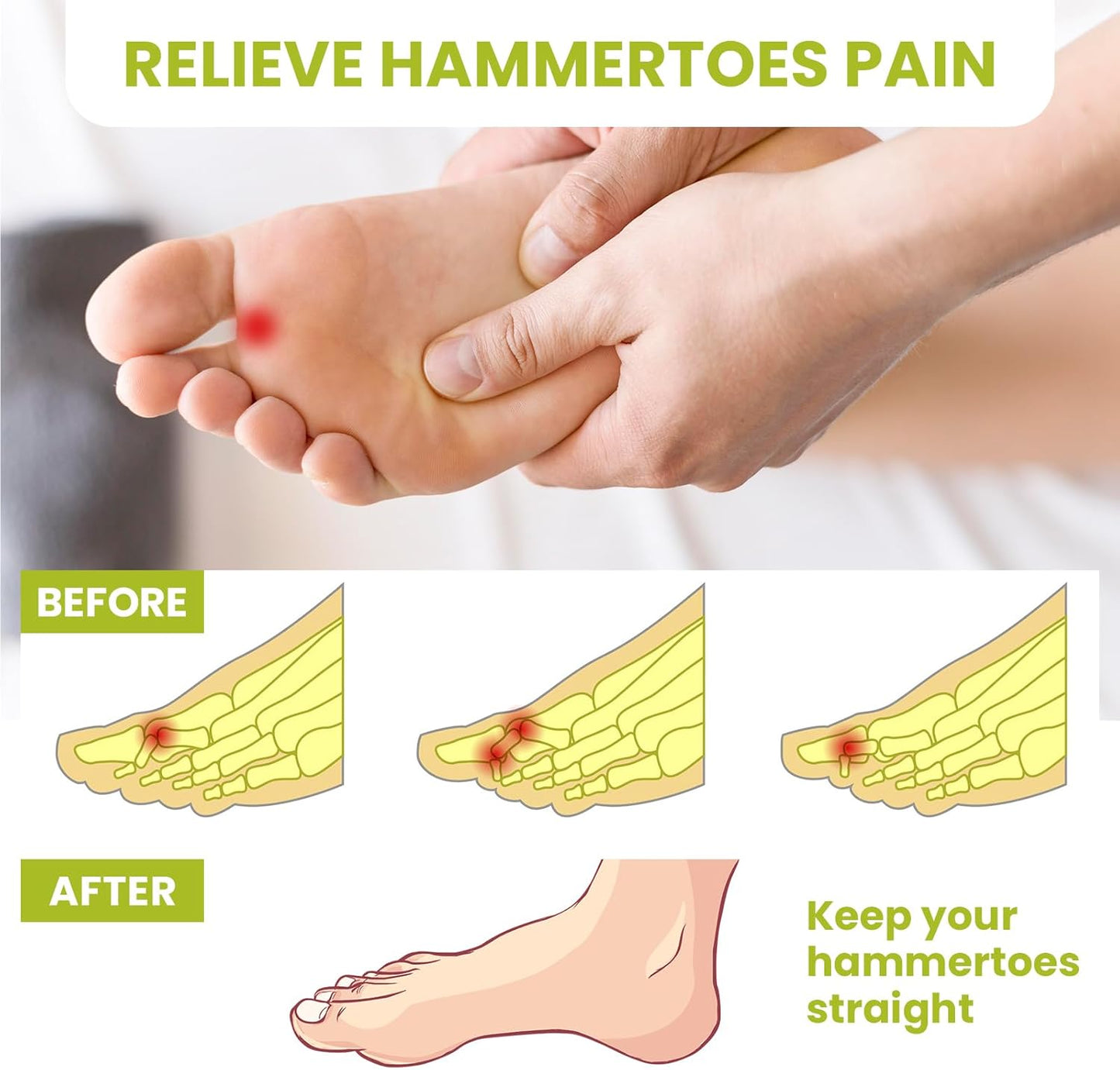 Bukihome Hammertoe Corrector Gel Toe Straighteners - 12 pcs Support Crest for Women & Men - Realign Bent, Crooked, Curled, Claw, Hammer Toes - Clear,Three Loop