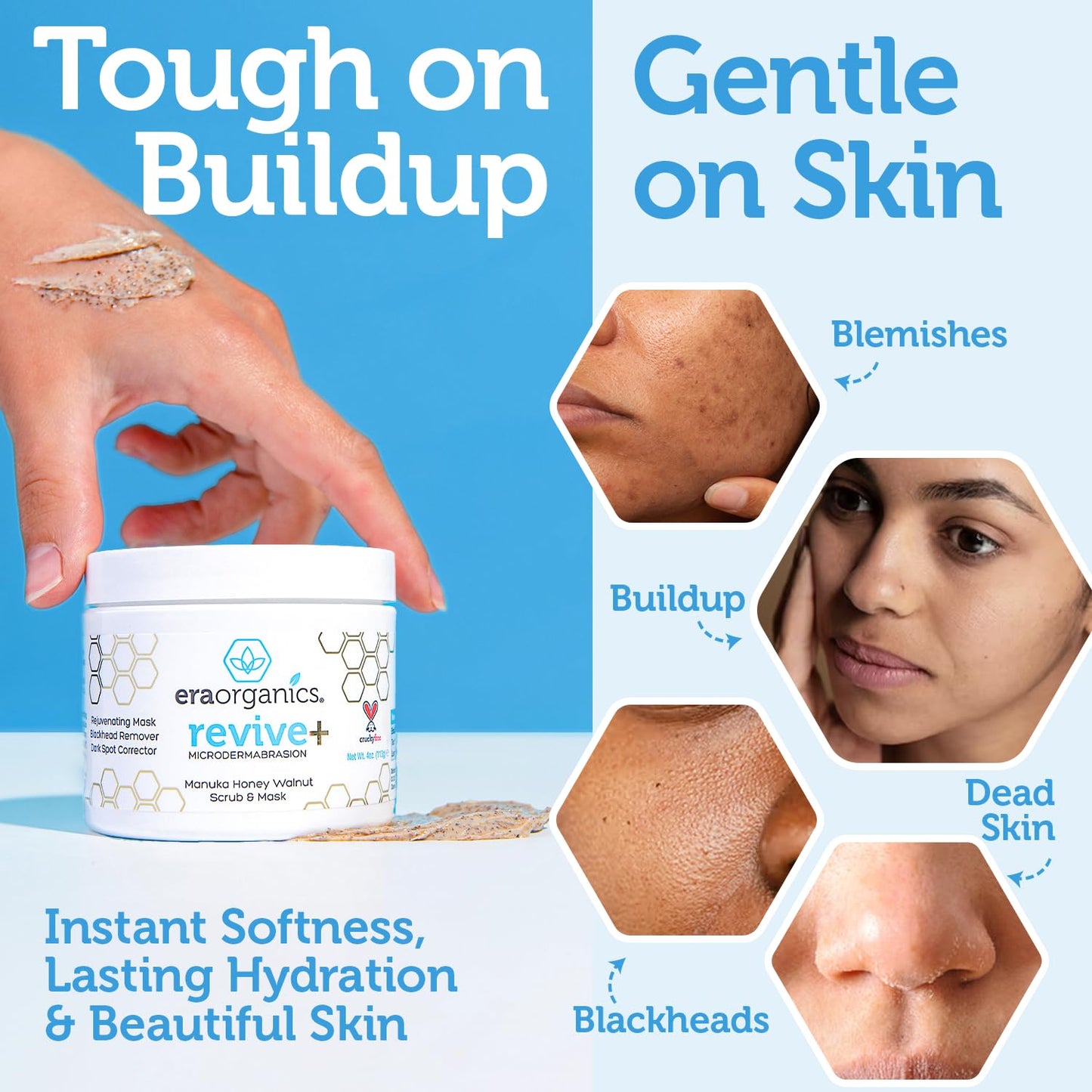 Era Organics Microdermabrasion Facial Scrub & Face Exfoliator - Spa Quality Exfoliating Mask with Manuka Honey Plus Walnut for Blackheads, Buildup, Wrinkles 4oz