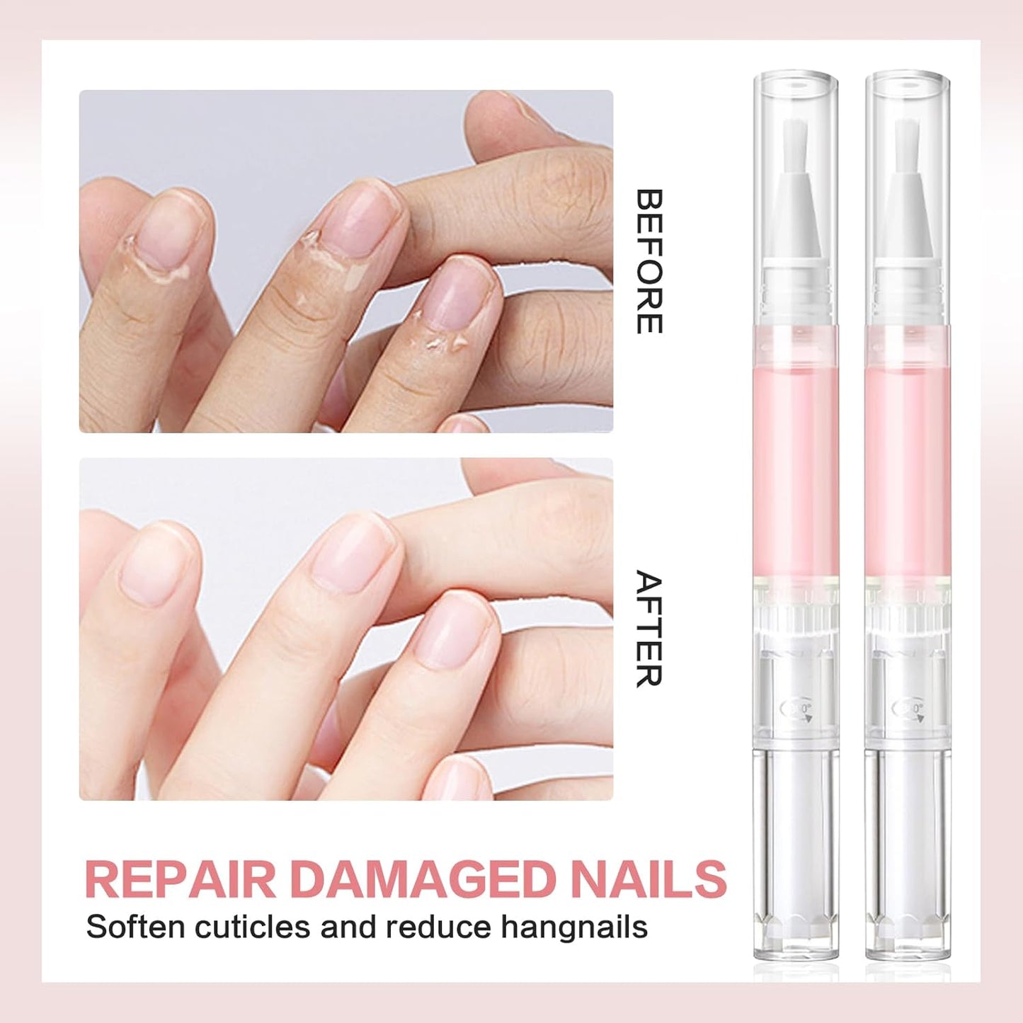 Radiant Nail Growth Oil, Nail Strengthener, Cuticle Oil for Nails, Moisturize Strengthen Nail Care Oil, Finger Edge Manicure Nourishing Pen, Anti-hangbnail removal, Nail Skin Edge Care (Lemon)