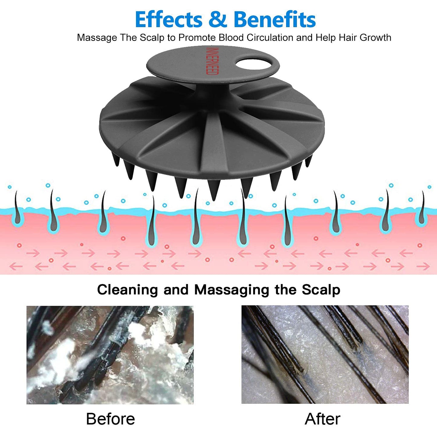 INNERNEED Scalp Massager Shampoo Brush, Wet & Dry Manual Scalp Care Head Scrubber Hair Washing, Soft Silicone Bristles, for Hair Growth, Dandruff Removal (Black+Pink)