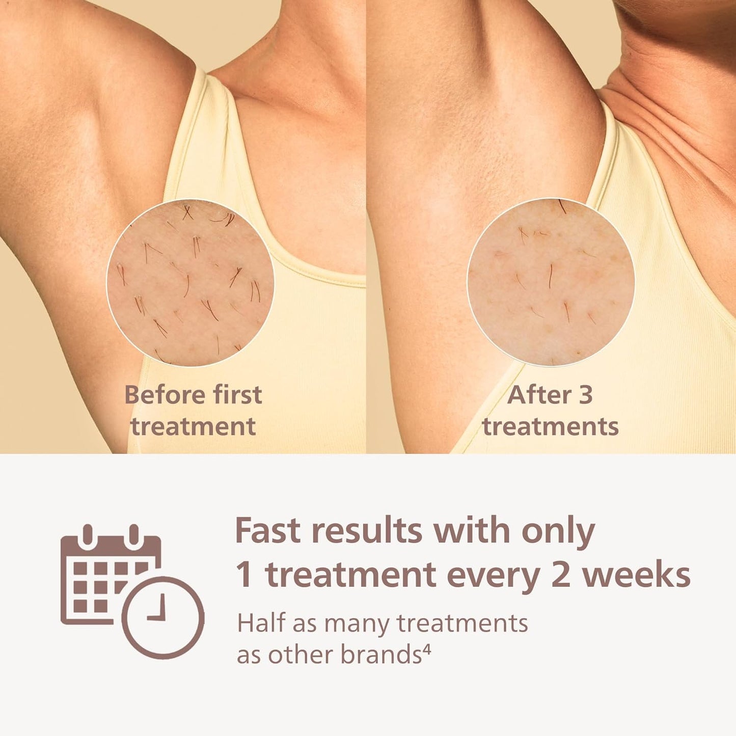 Philips Lumea 8000 Series IPL Hair Removal Device - Permanent Visible Hair Reduction Done at Home, SenseIQ Technology, 2 Attachments for Body & Face, for Women & Men, BRI932/03