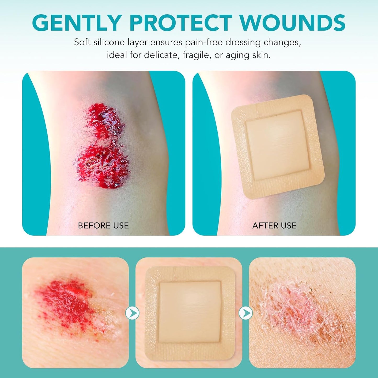 Silicone Foam Dressing Ag Sterile Wound Bandage with Waterproof Gentle Silicone Adhesive Border (10 Packs), 4"x 4" Breathable Ultra Absorbent Pads (4x4 Inch (Pack of 10))