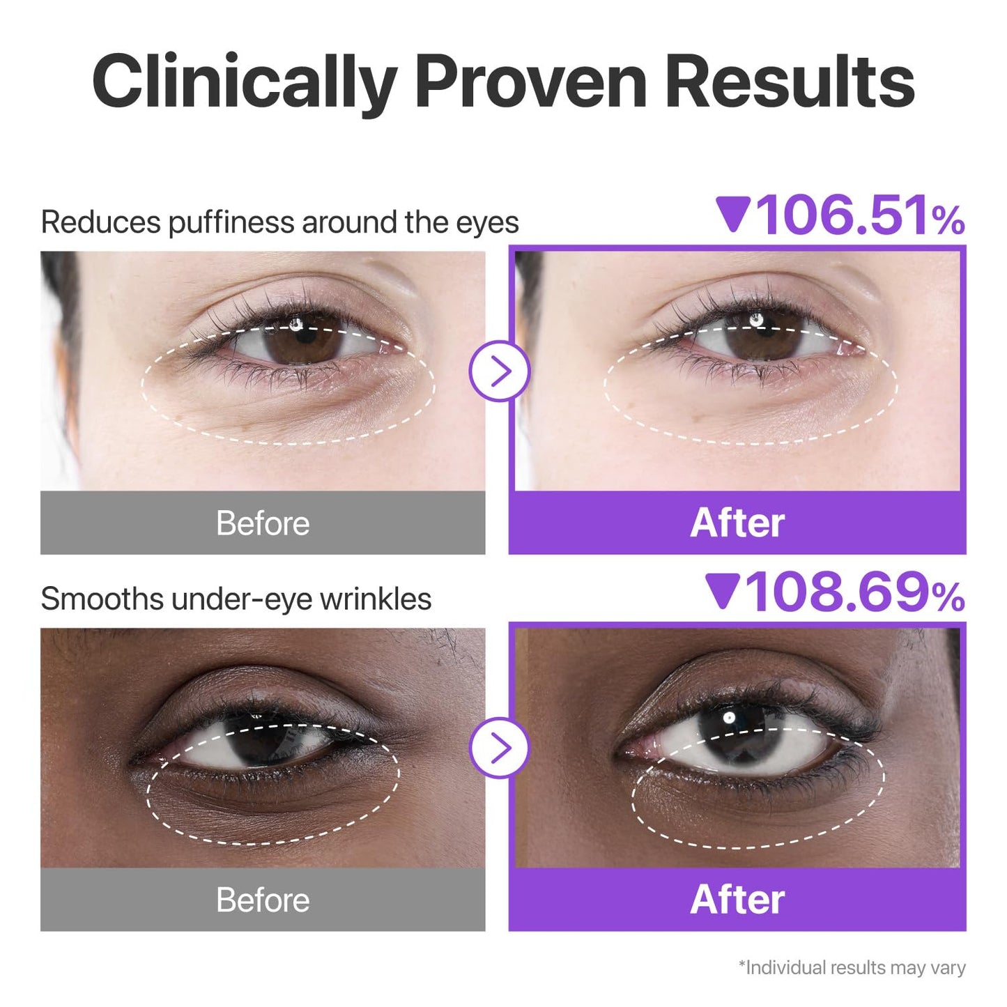 numbuzin No.9 Eye Patches | NAD+ Collagen Under Eye Patches | Dark Circles, Cooling, Depuff Eyes, Wrinkles with Peptides, Caffeine, Niacinamide | Plumping and Firming | 5 Pairs, 10 Patches