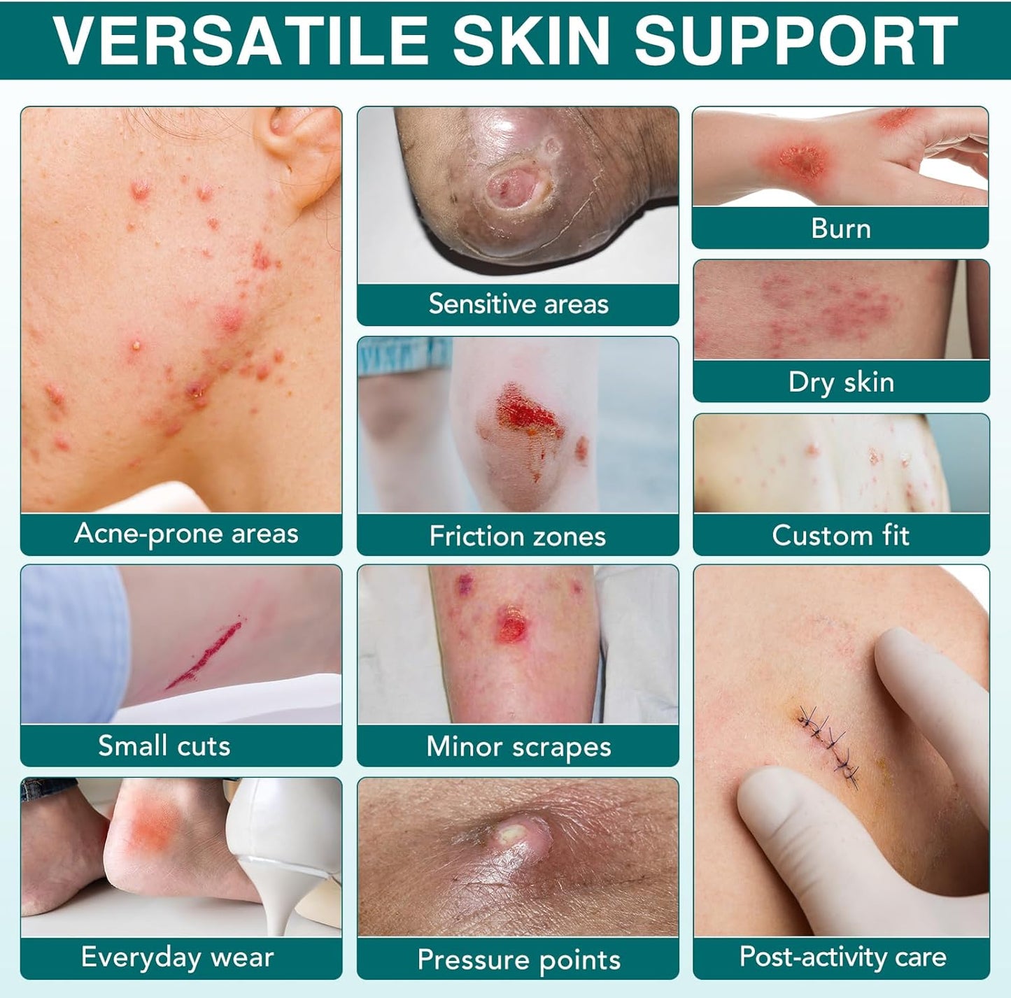 Hydrocolloid Roll for Wound Care, 2in*12ft Hydrocolloid Bandages Patch with Self-Adhesive, Cut-to-Size Ultra Absorbent, Flexible & Waterproof, First Aid Kit Essential