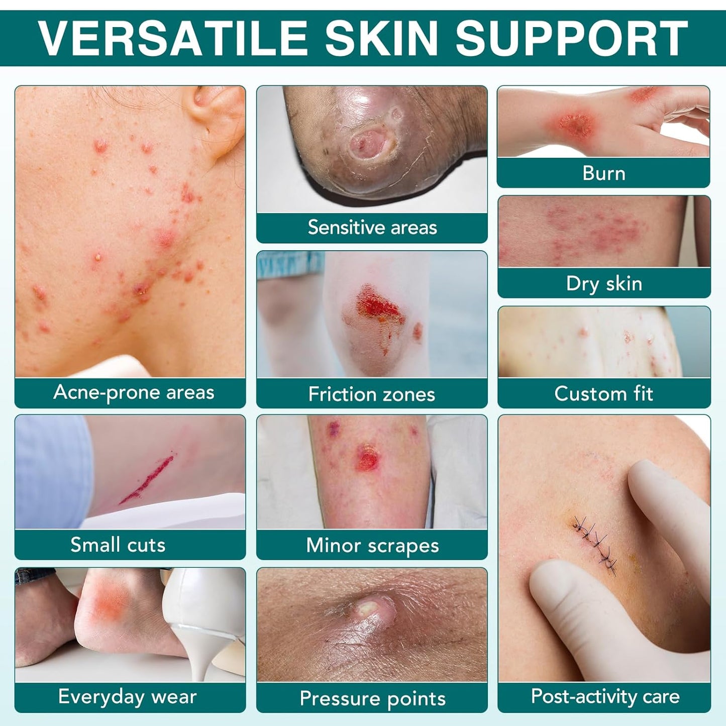 Hydrocolloid Roll 2in*11.8ft, Hydrocolloid Bandages for Wound Care, Flexible & Waterproof Cuttable Hydrocolloid Dressing Roll with Self-Adhesive