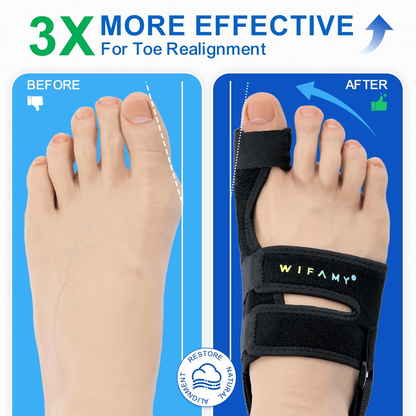 Bunion Corrector For Women Big Toe: Soft Gel Toe Separators For Women - Adjustable Straps & Breathable Design - Day/Night Pain Relief For High Heels & Flats