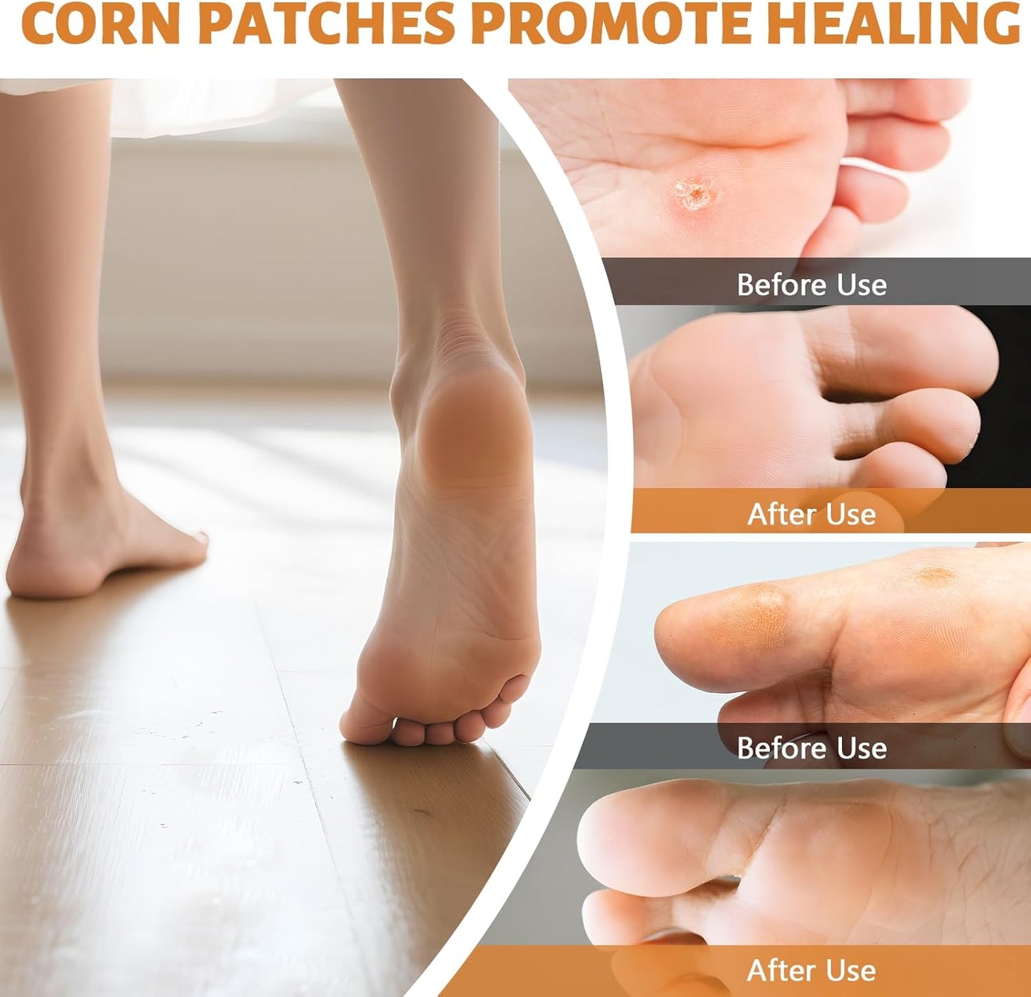 Corn Remover Pads for Feet & Toes - 30 Medicated Patches with 40% Salicylic Acid | Extra Strength Callus Treatment for Small Corns & Calluses, All-Day Adhesive Protection for Active Adults