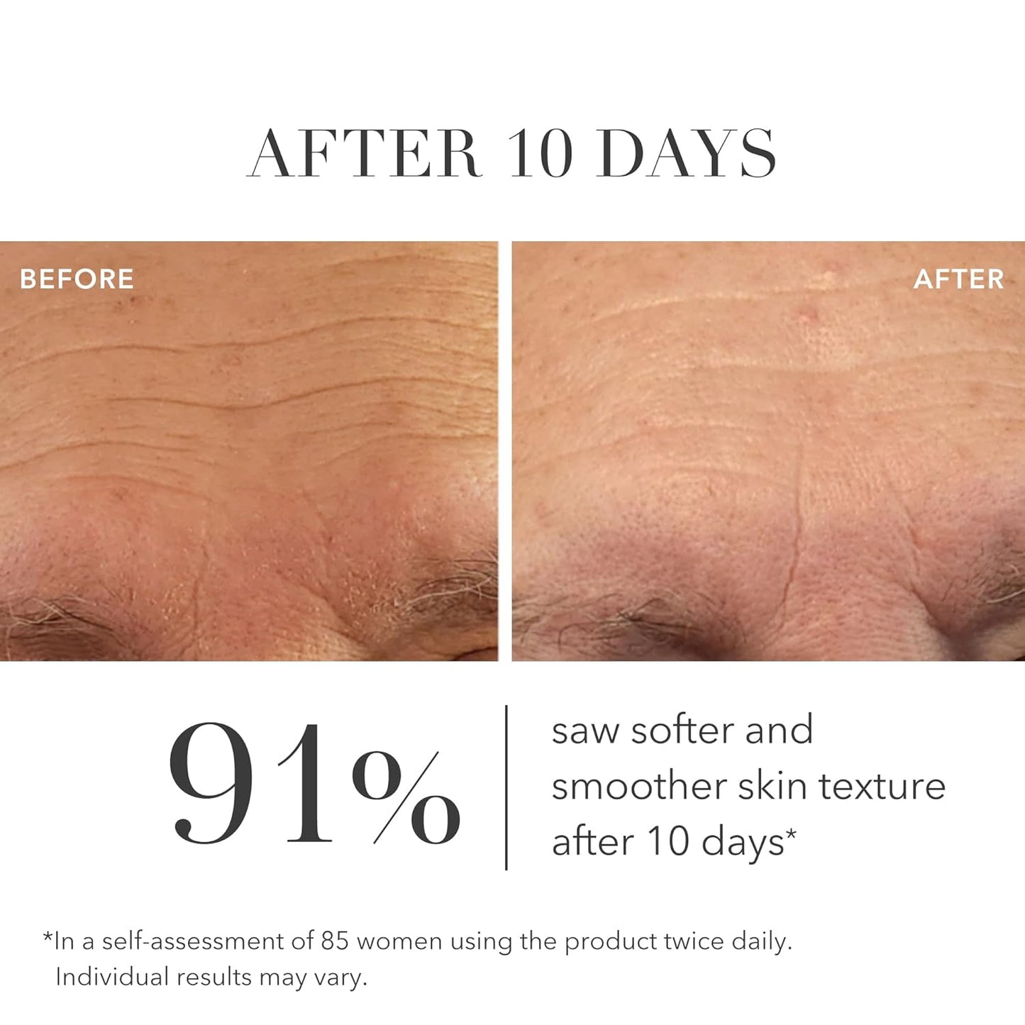 Algenist GENIUS Mini Liquid Collagen Serum - Firming and Hydrating Face Serum with Collagen + Vitamin E - Helps Visibly Minimize Fine Lines + Wrinkles and Improve Elasticity (6.2ml)