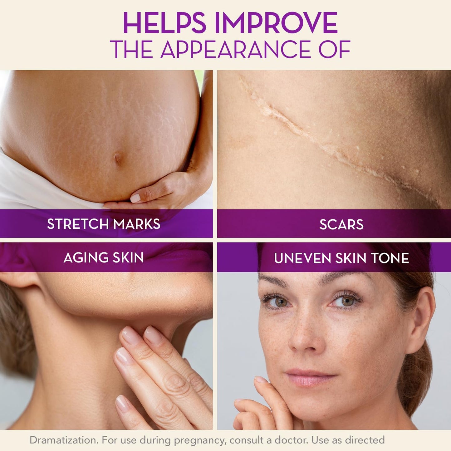 Cicatricure Cica Oil for Stretch Marks & Scars, Visible Results in 4 Weeks, Pregnancy Must-Haves Body Oil with Vitamin E, Stretch Mark Oil, Scar Treatment with Botanical Ingredients, 6.7 fl oz