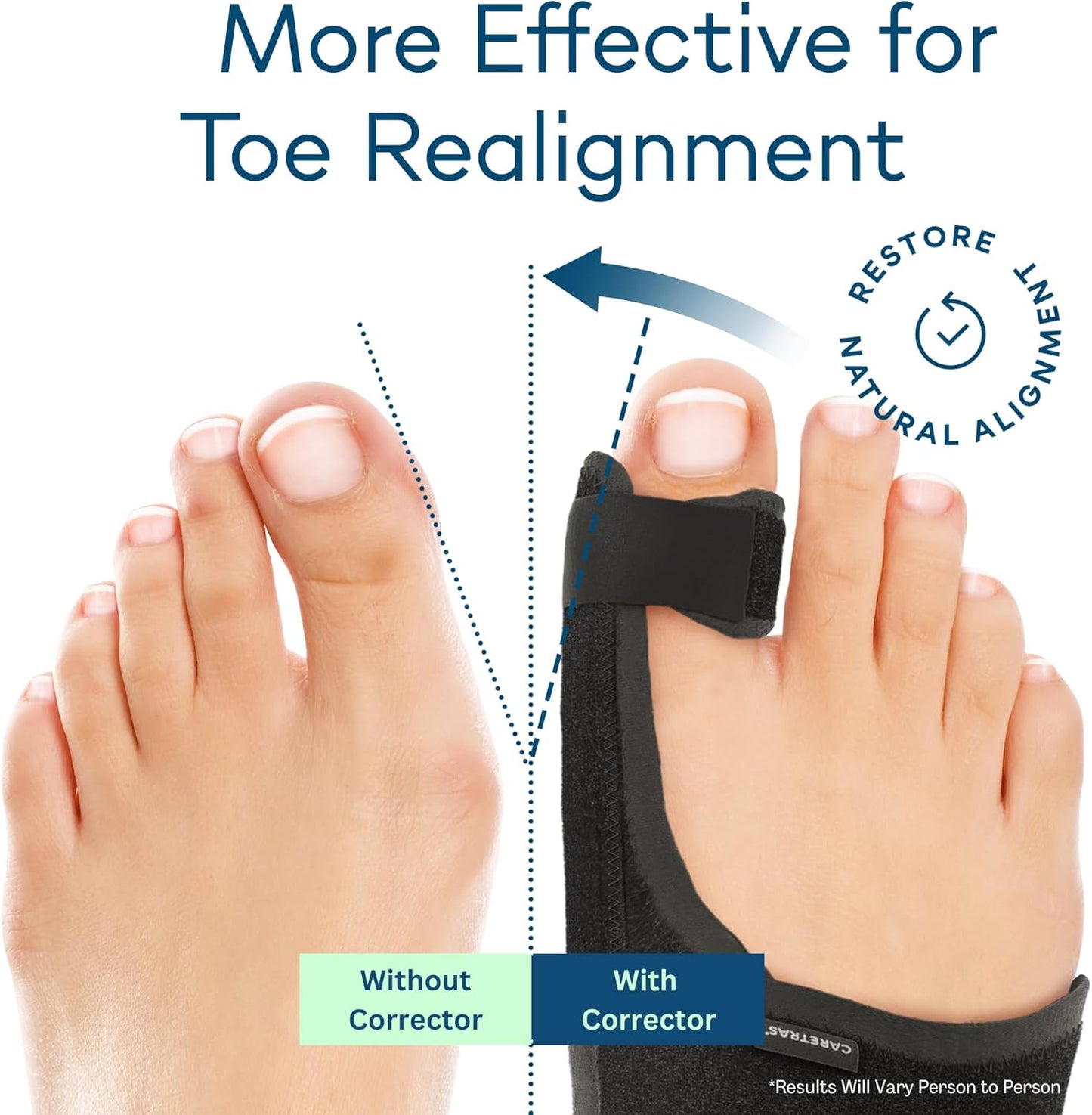 Caretras 2-Pack Bunion Corrector for Women & Men, Orthopedic Bunion Splint for Hallux Valgus Pain Relief, Big Toe Separator, Adjustable Day/Night Support, Comfortable Hammer Toe Straightener