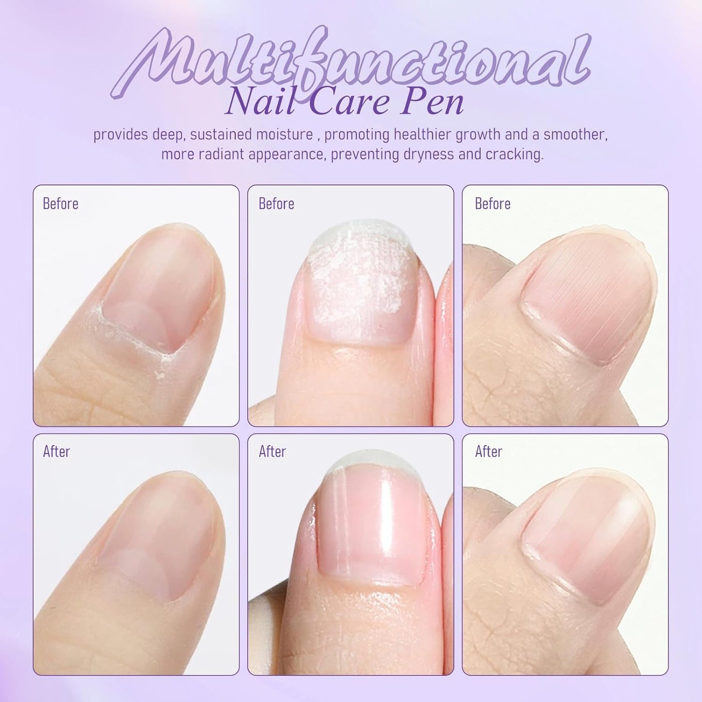 3-in-1 Cuticle Oil Pen, Cuticle Pusher Pen with Ceramic Tip, Upgraded Rotary Oil Discharge Portable Nail Care Pen Cuticle Remover for Hangnails Dry & Damaged Nails, Moisturize Strengthen(2pcs)