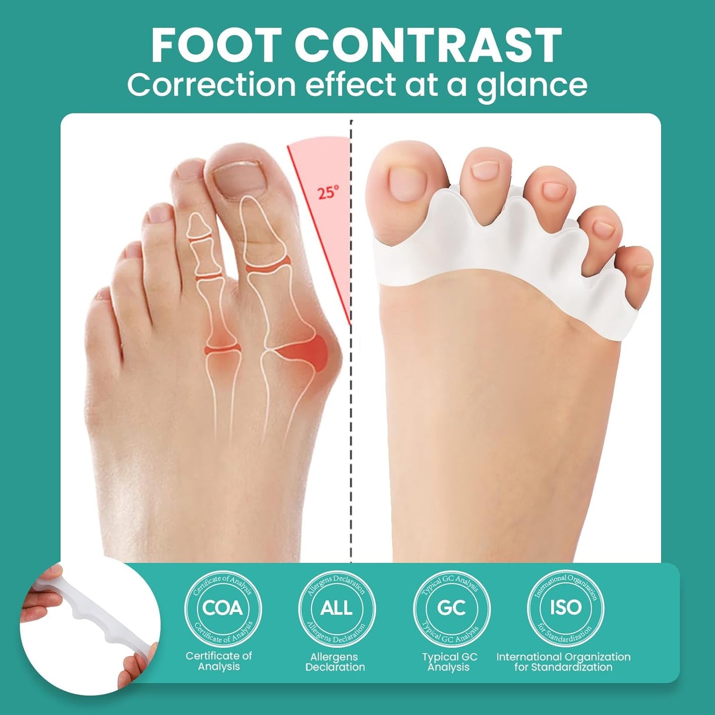 Welnove Toe Separators Spacers for Women - 8 Pack Gel Toe Straightener to Correct Bunions and Relieve Foot Pain - Silicone Toe Spacers for Hammertoe Yoga Practice - White
