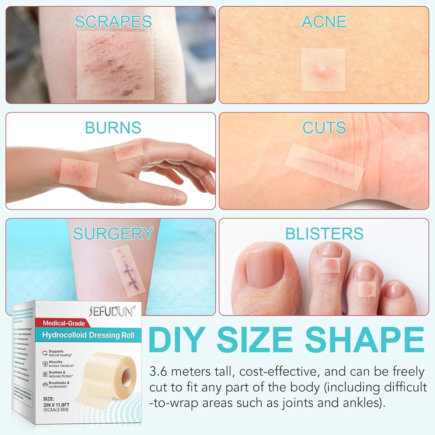 Hydrocolloid Roll for Wound Care, Cut-to-Size, Hydrocolloid Patch Bandages with Self-Adhesive, Ultra Absorbent, Waterproof, Home Essential, 2in x 11.8ft