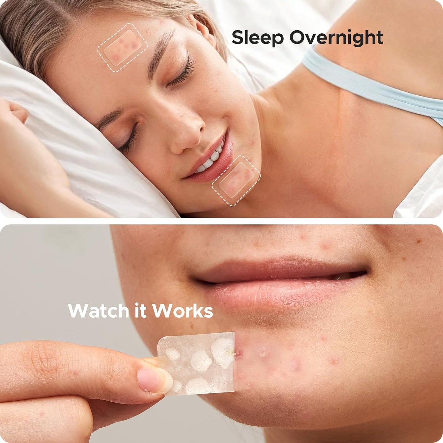 Large Pimple Patches for Face, 7 Sizes Big Acne Patches, XL Hydrocolloid Bandages for Body, Chin, Forehead, Nose, Back Blemish Zit Breakouts, Hydrocolloid Patch (Square, Strip, Dot 142 Count)