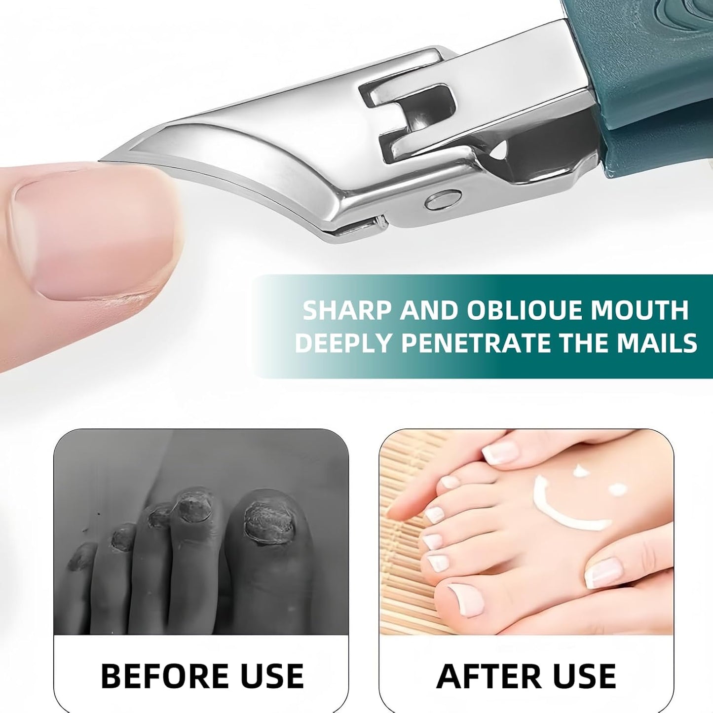 9-Piece Ingrown Toenail & Thick Nail Clipper, Eagle Beak Beveled Nail Clippers,Angled Nail Clippers,Suitable for Men,Women,and Comfort-Seeking Seniors at Home,in The Office,and During Travel (Green)