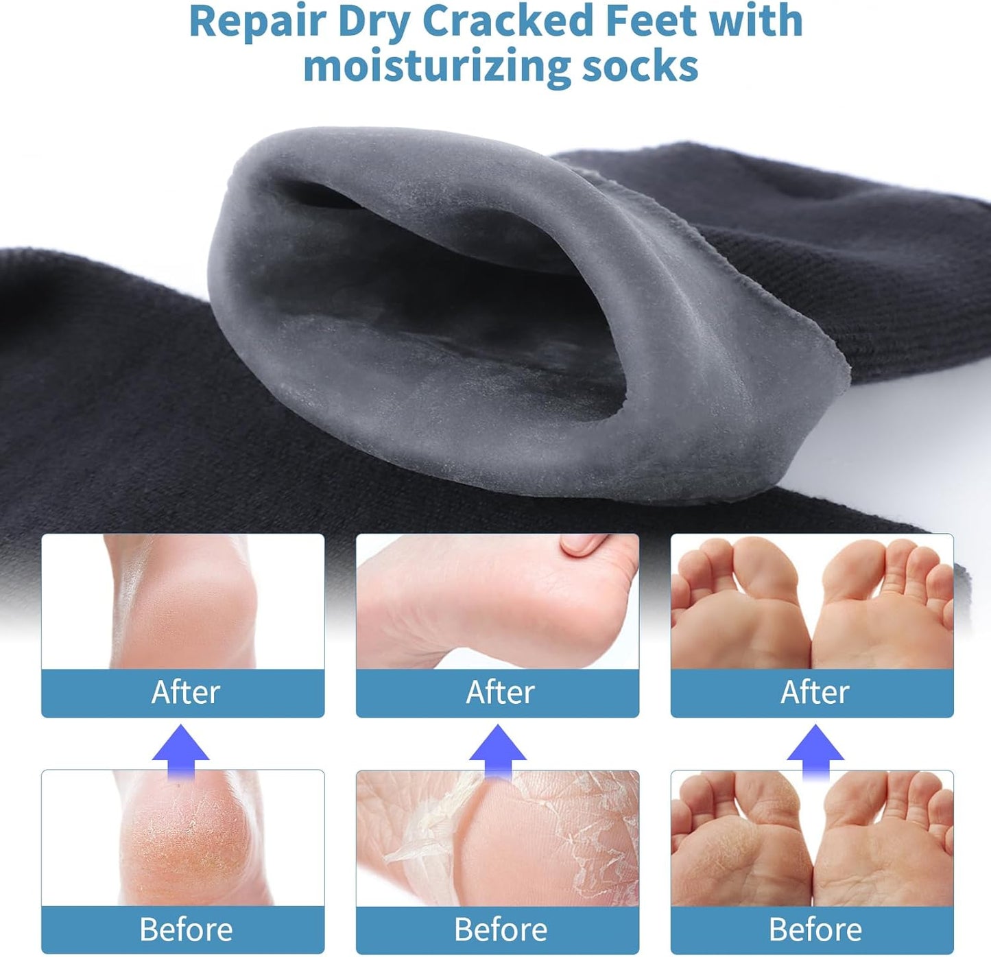 11" Large Silicone Moisturizing Socks for Men - 2 Pairs Soft Foot Care Socks - Feet Moisturizing Socks for Dry Cracked Feet (Size L)