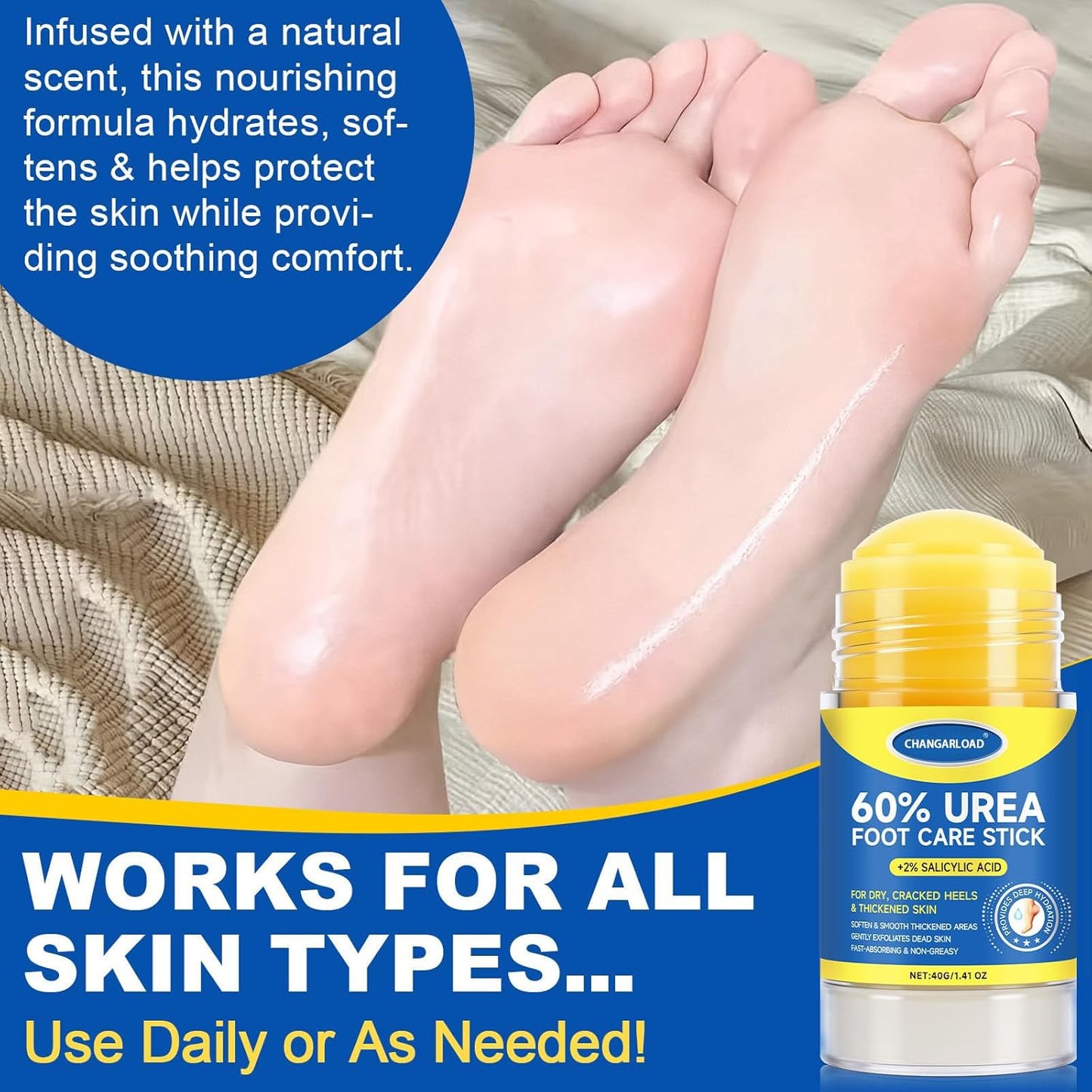 60% Urea + 2% Salicylic Acid Foot Cream–Ultra-Moisturizing Formula, Exfoliates Dead Skin, Softens Dry, Cracked Skin on Feet, Knees, Hands, Elbows. Helps soften callused, rough, or tender areas 2.82oz