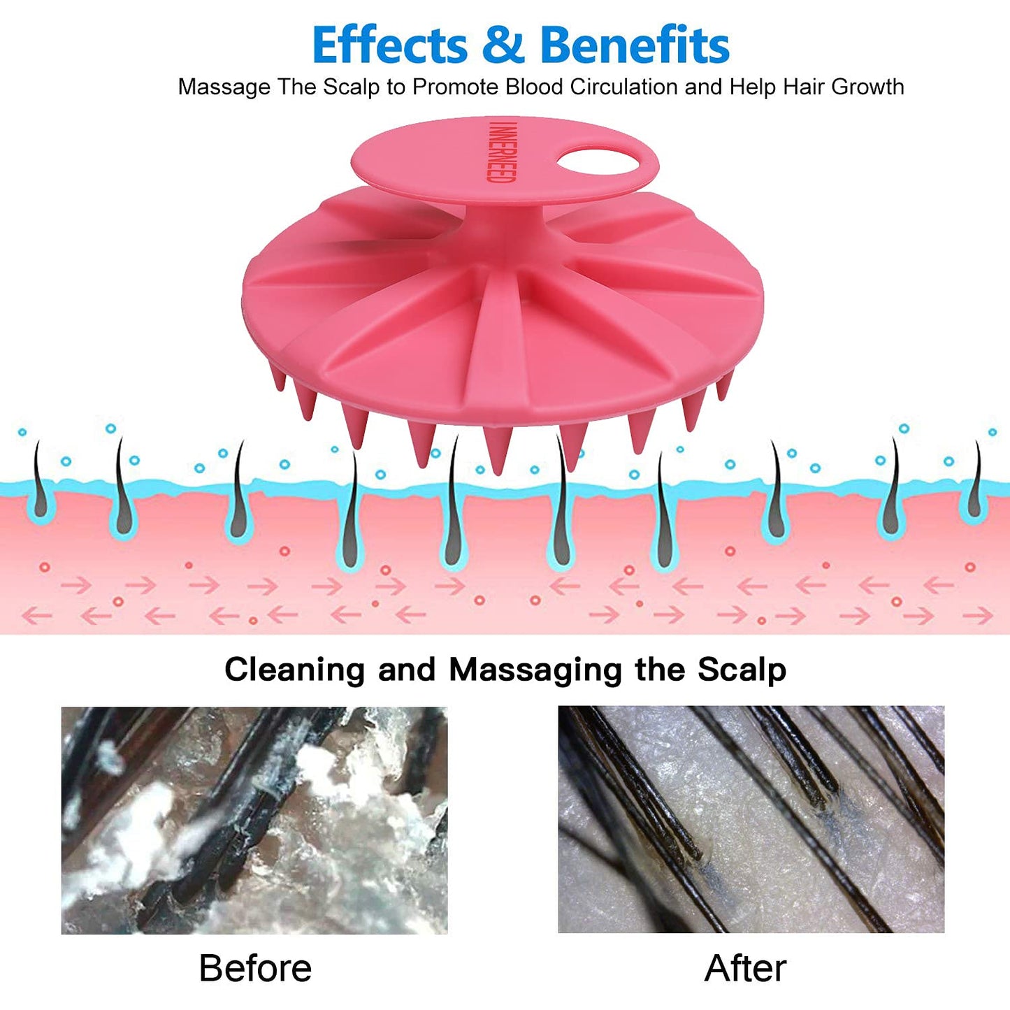 INNERNEED Scalp Massager Shampoo Brush, Wet & Dry Manual Scalp Care Head Scrubber Hair Washing, Soft Silicone Bristles, for Hair Growth, Dandruff Removal, Comfortable for All Hair Types (Pink)