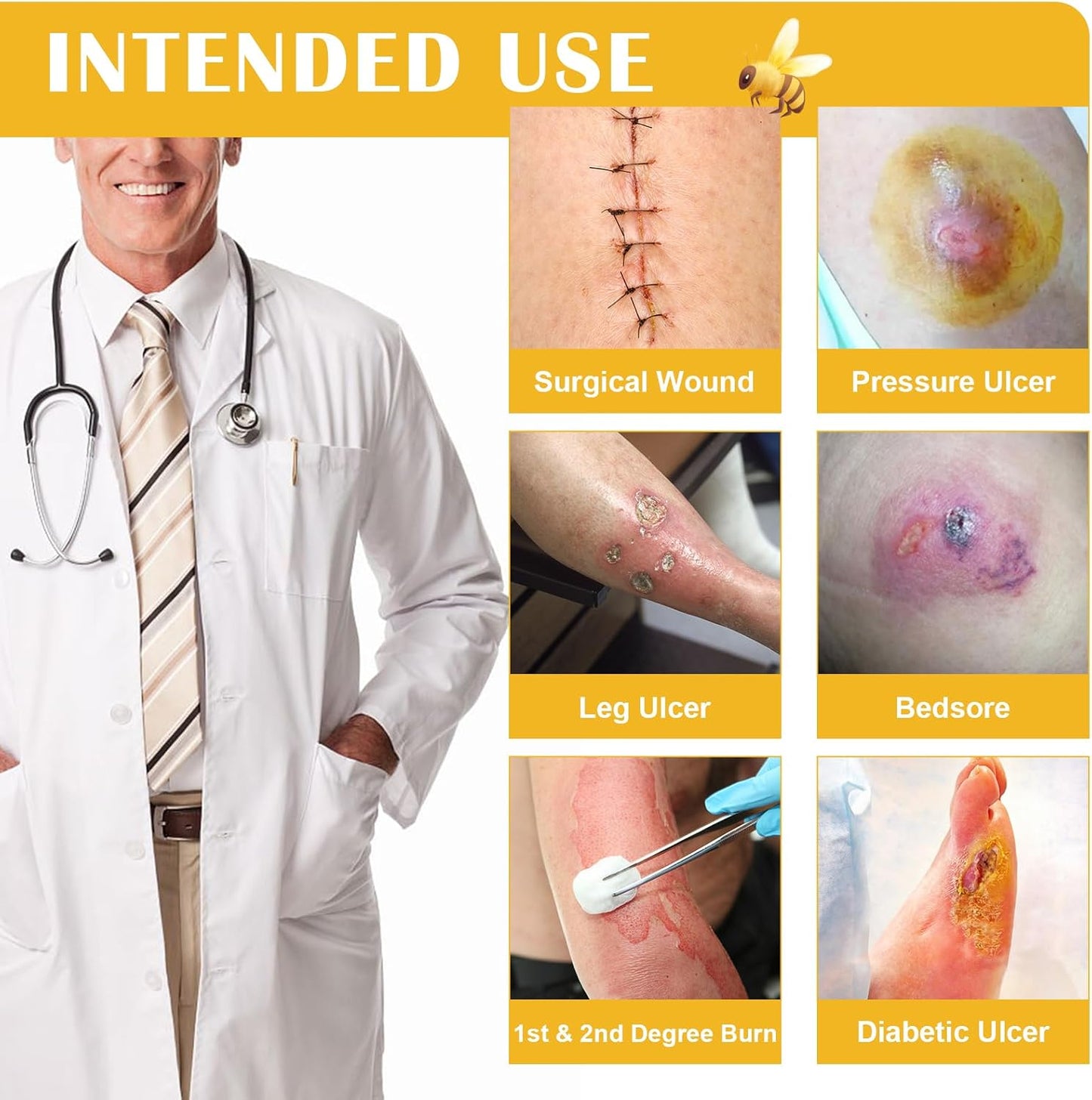 Honey Gauze Wound Dressing, 4" x 4" Manuka Honey Wound Care, Medical Grade Honey Bandages for Wound Care, Honey Patch for Faster Healing from Burns, Abrasions, Cuts and Scalds (Pack of 10)