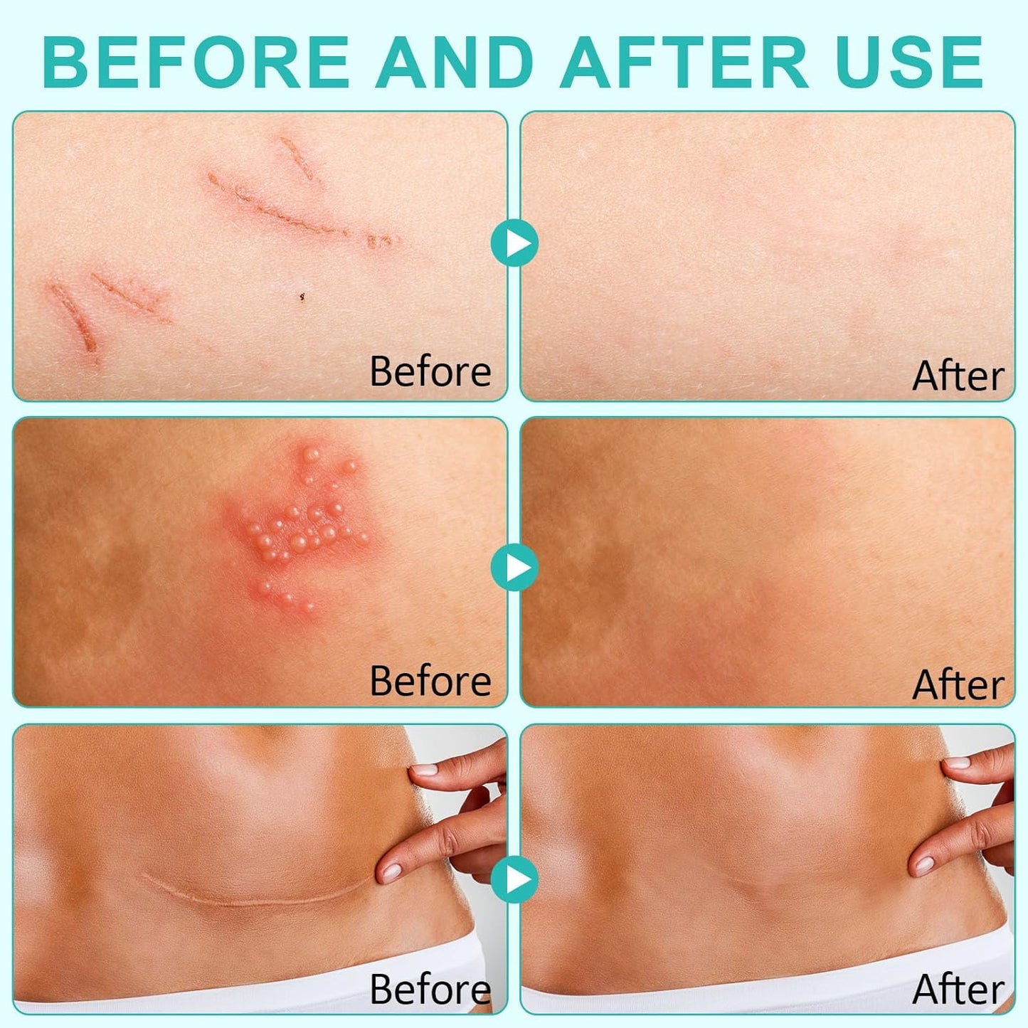 Hydrocolloid Roll, Medical-Grade Hydrocolloid Bandages for Wound Care, Extra Large Hydrocolloid Patch Bandages with Self-Adhesive, Cut-to-Size, Flexible Waterproof,First Aid Kit Essential(2in*16.4ft)