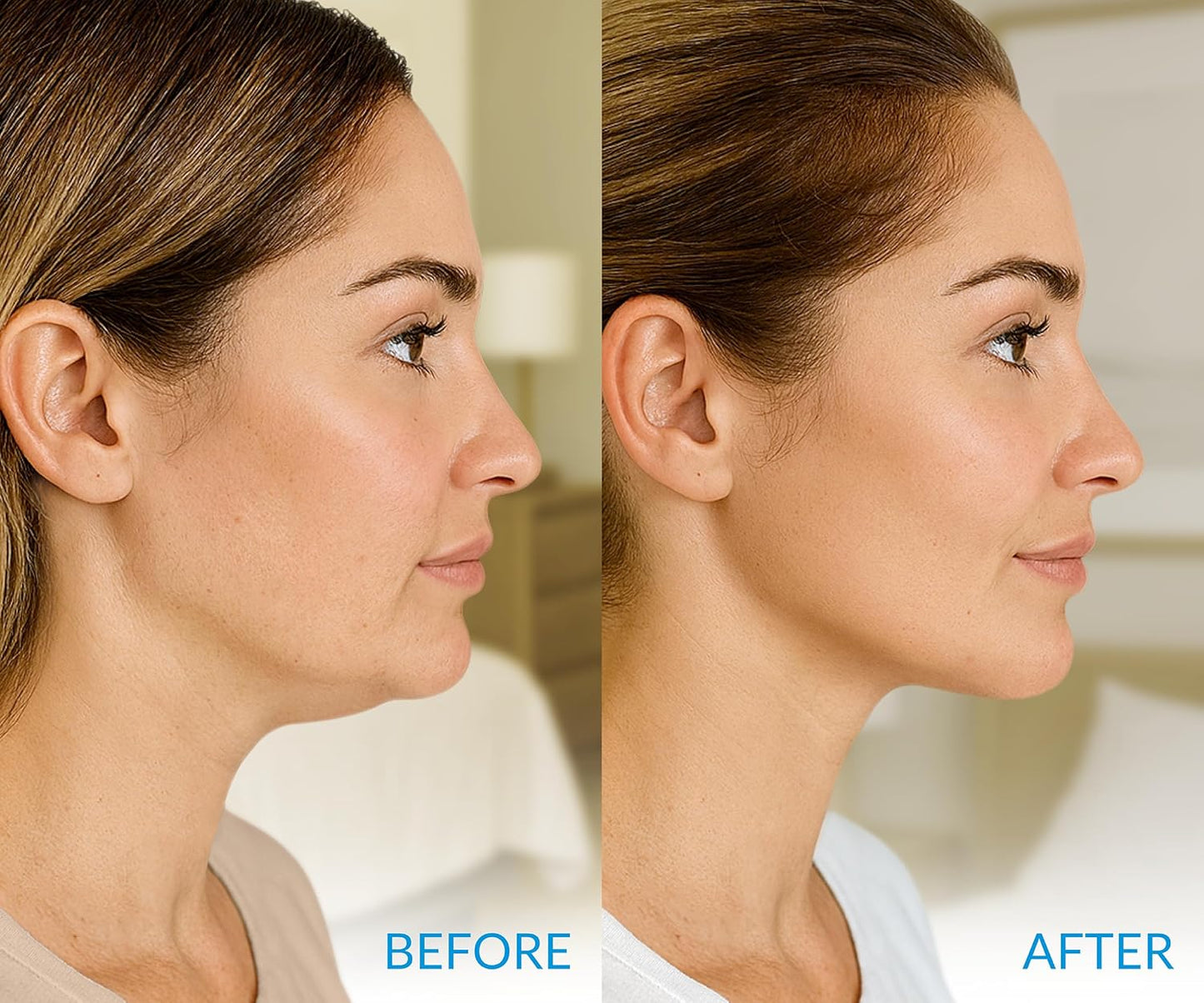 Stylia MaxiLift V-Line Lifting Collagen Face Mask - Advanced Double Chin Reducer - Jawline Shaper - Neck Firming and Tightening Mask with Hyaluronic Acid & Aloe Vera - Chin Strap for Sleeping (5PC)