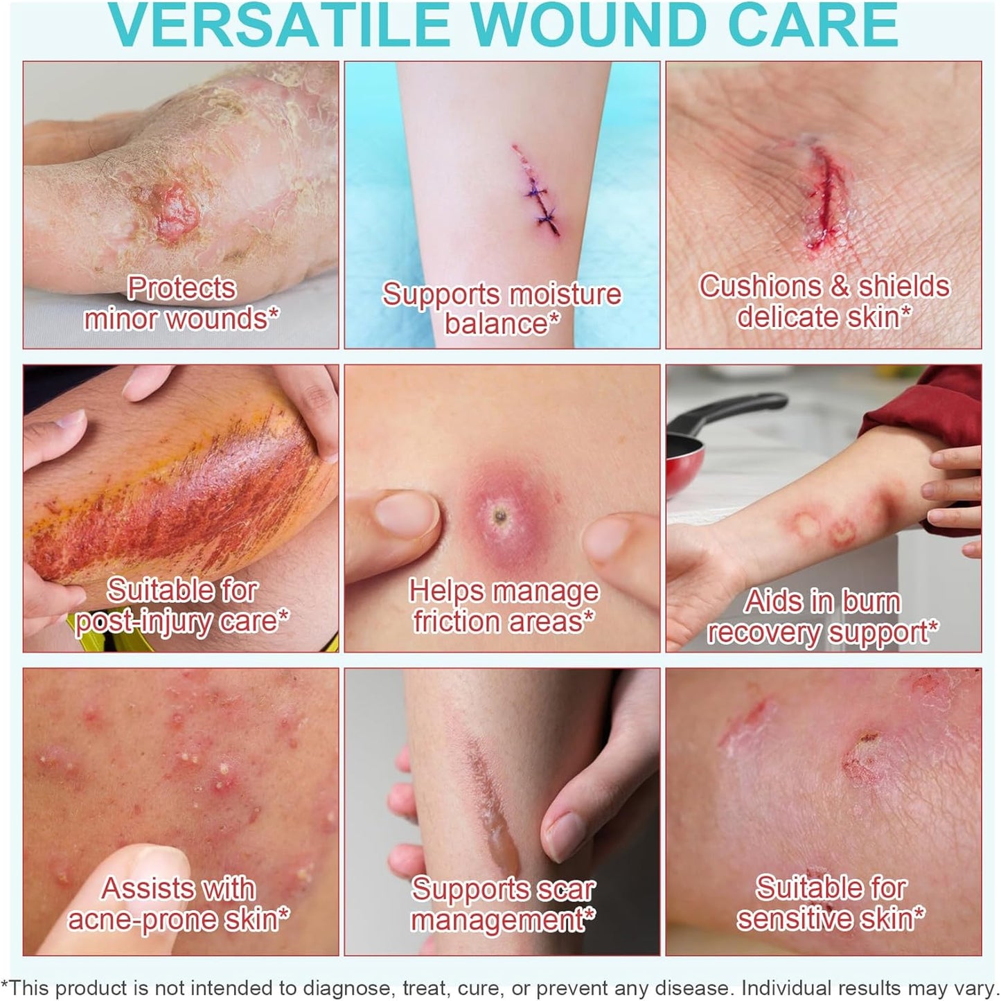 Hydrocolloid Roll 2 inch x 11.8 ft, Hydrocolloid Bandages for Wound Care, Flexible & Waterproof Self-Adhesive Hydrocolloid Patches Bandages, Cut-to-Size