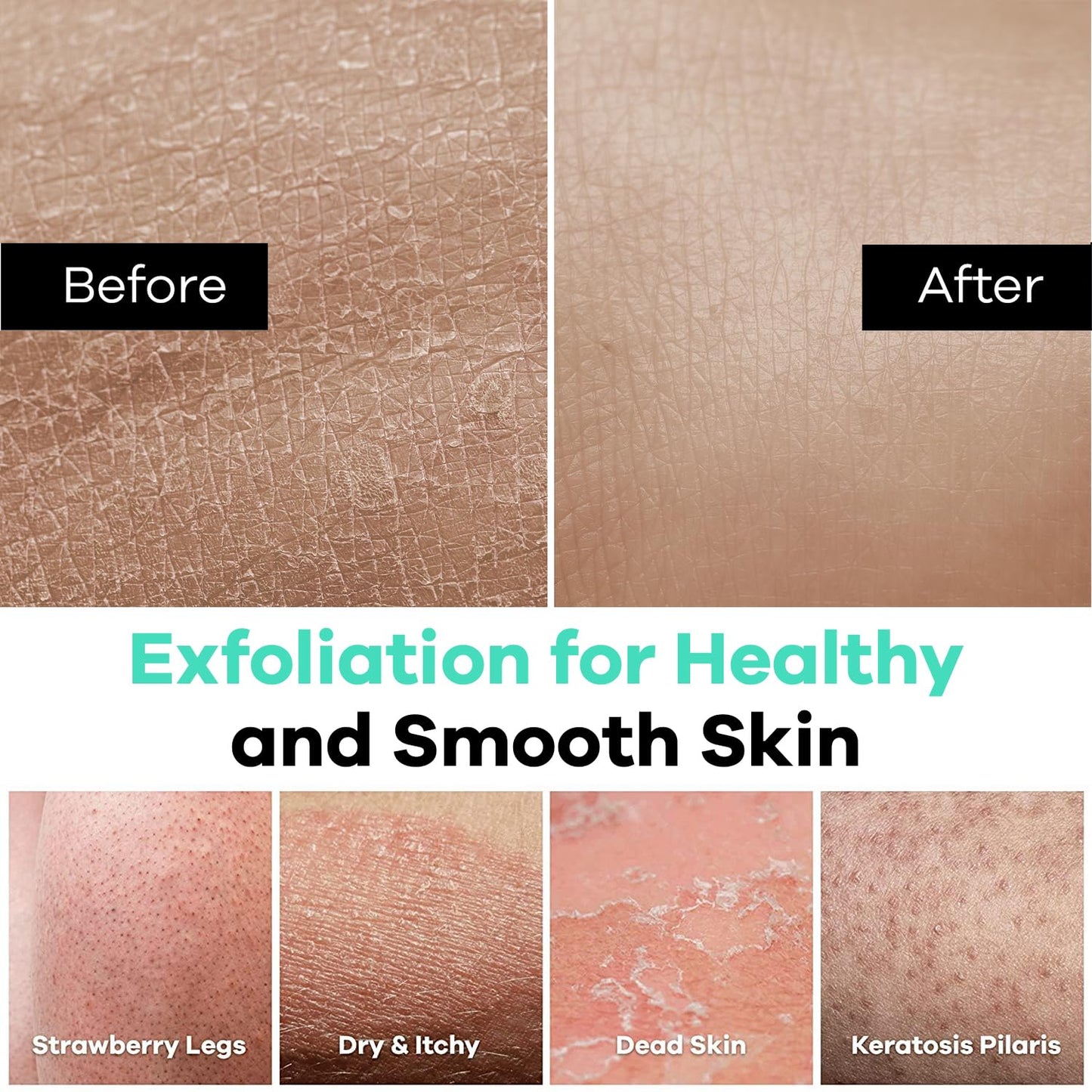 Dermasuri - Deep Exfoliating Glove - Korean Exfoliating Mitt - Reusable Body Scrubber for Shower - Buffs Dry Dead Skin - Keratosis Pilaris Treatment Scrub - Stocking Stuffer Gifts for Women & Men - XL