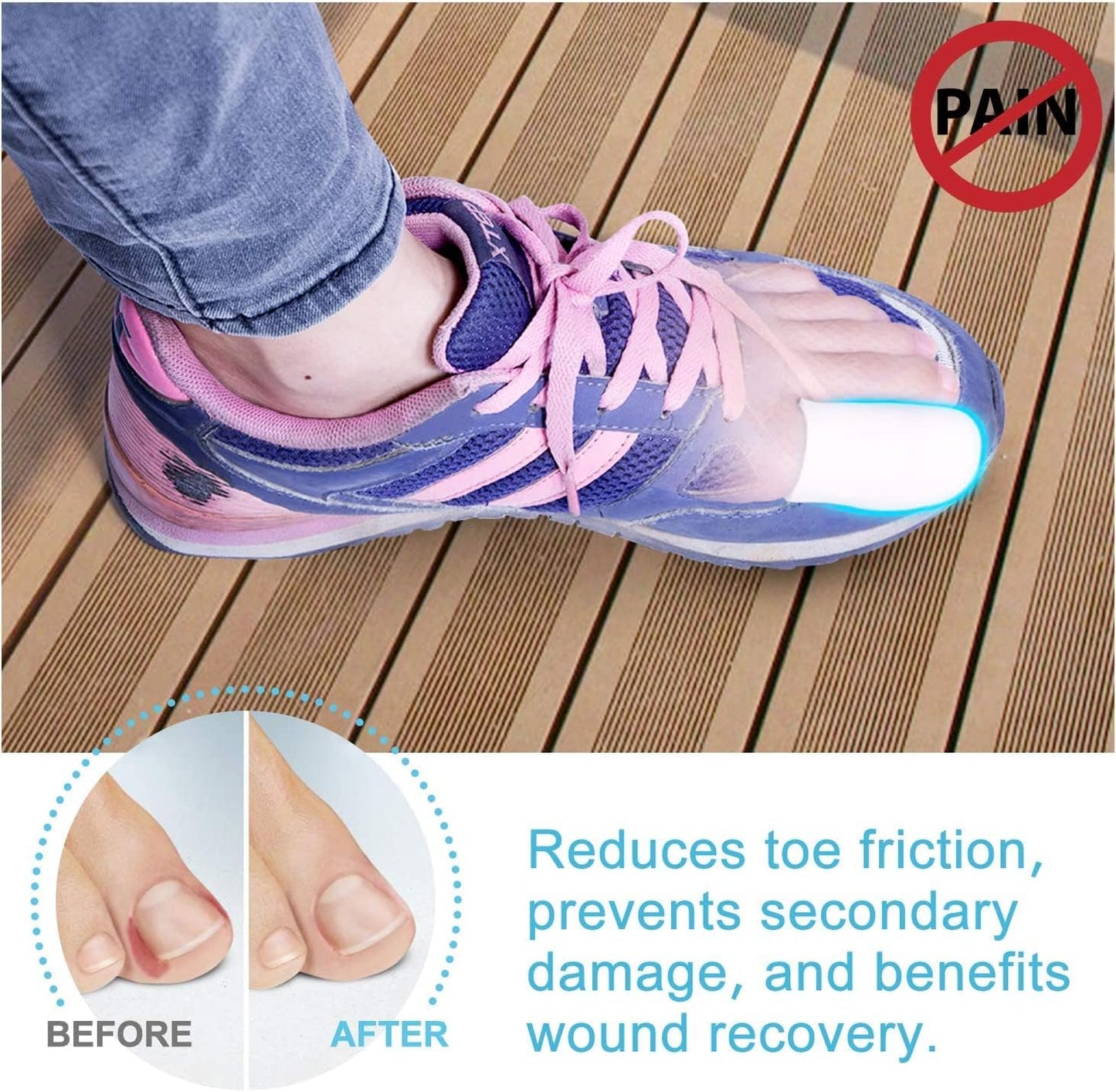 Bukihome 12 PCS Toe Protectors, Silicone Toe Caps to Cushion Toe Blister, Corn, Callus, Hammer Toes,Great for Running, Walking, Stop Toe Pain (White,Multi-Size)