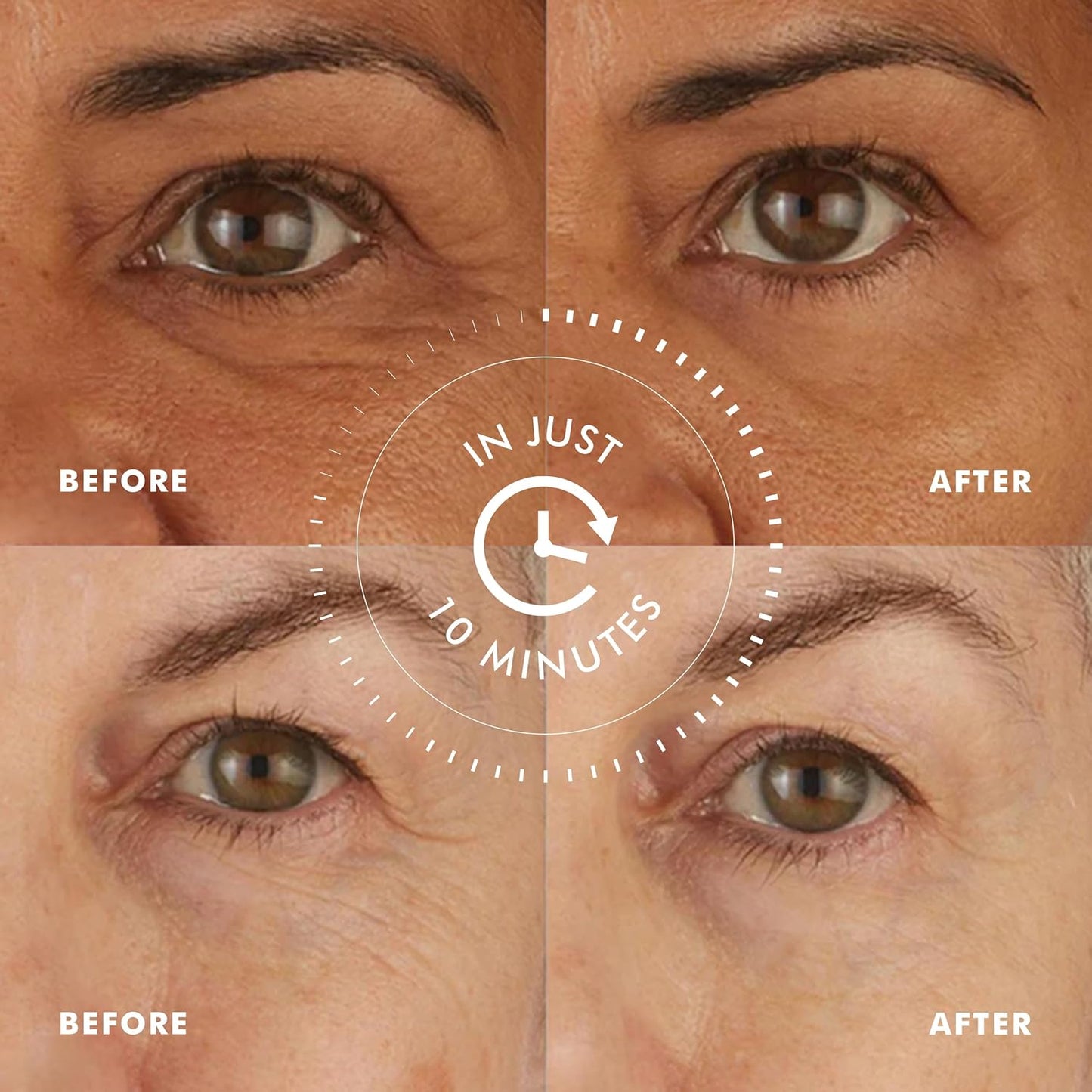 Skyn ICELAND Hydro Cool Firming Under Eye Patches, Instant Cooling for Puffy, Tired Eyes with Peptides and Coenzyme Q10, 10 Minute Treatment, Vegan, All Skin Types, 12 Pairs