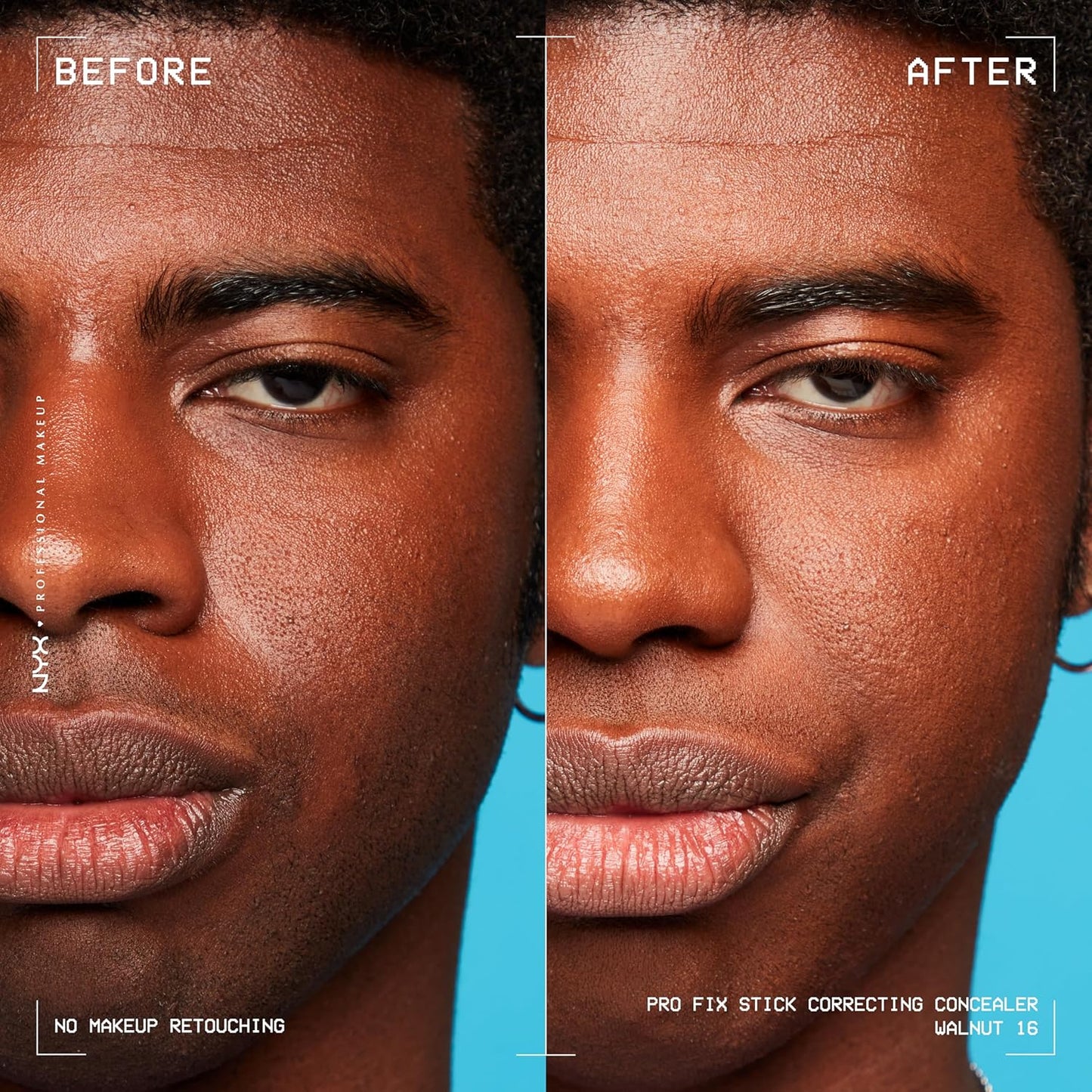 NYX PROFESSIONAL MAKEUP Pro Fix Stick Correcting Concealer, Buildable Medium Coverage Concealer Stick - Walnut